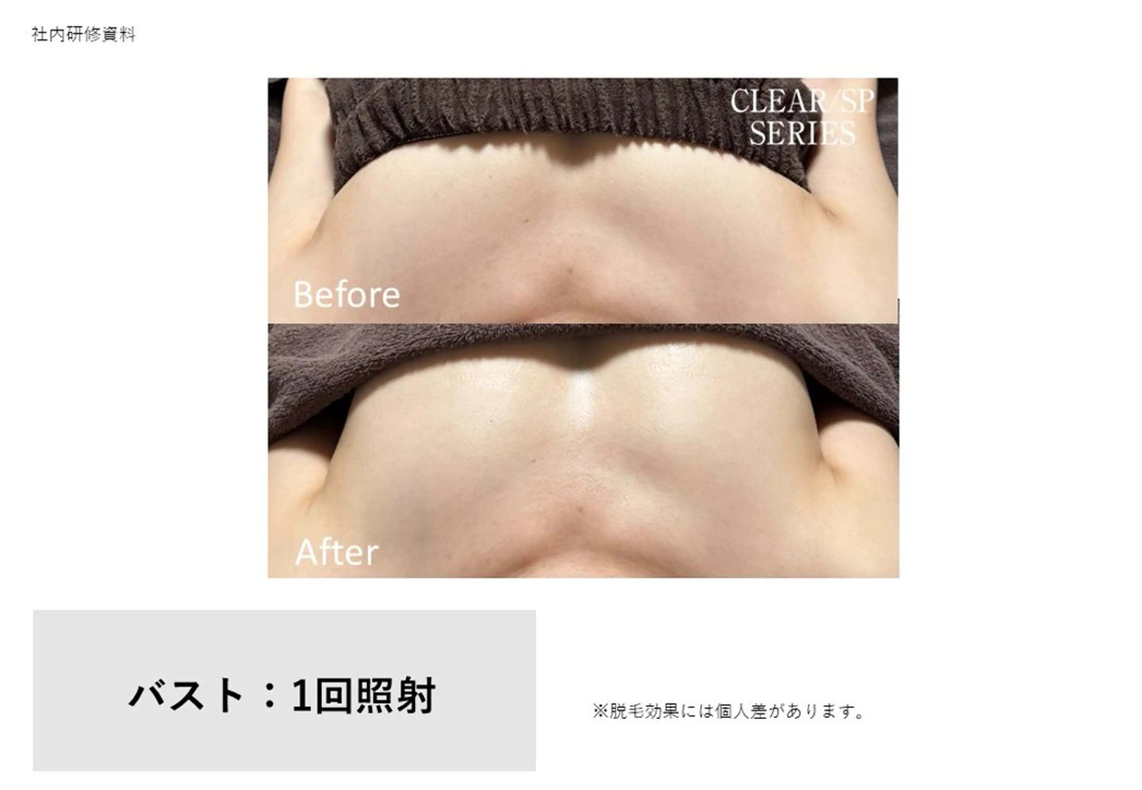 エステ Amaranth所属・Lupinus 小顔矯正のエステ・リラクイメージ