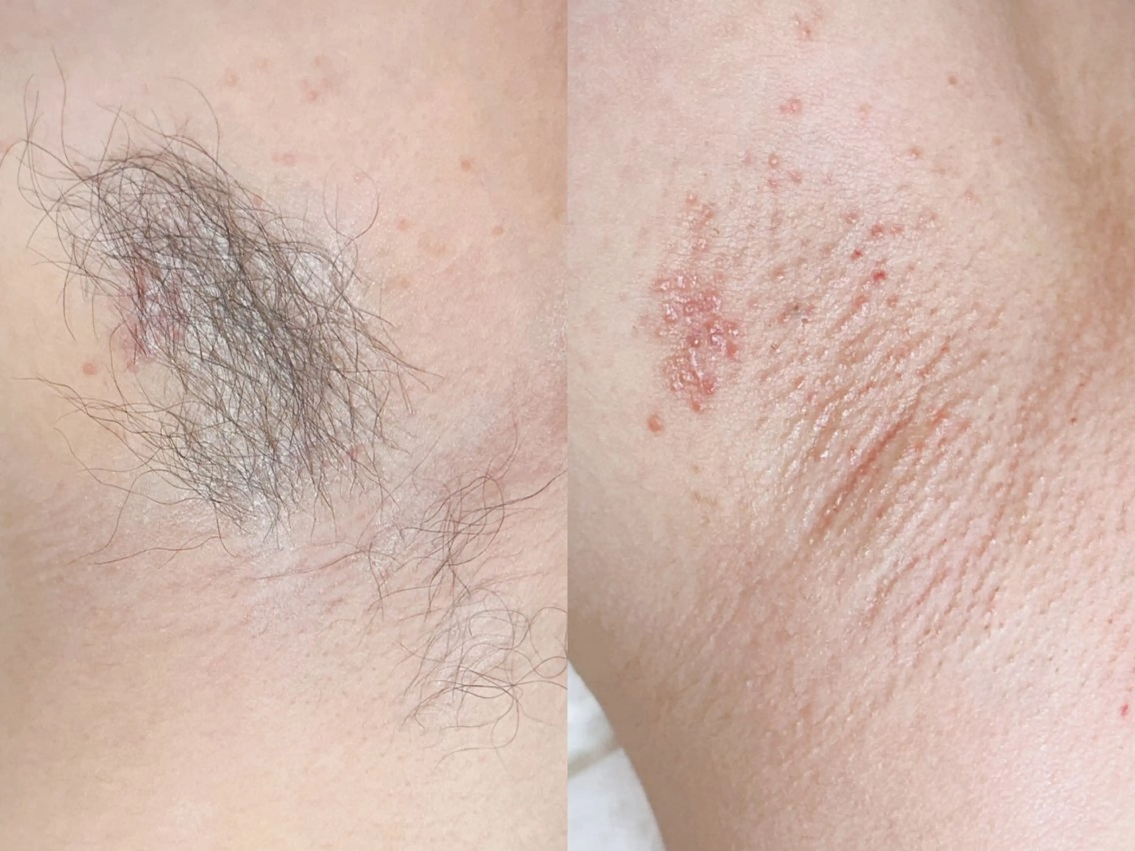 Hit. シュガーリング豊橋のエステ・リラクイメージ