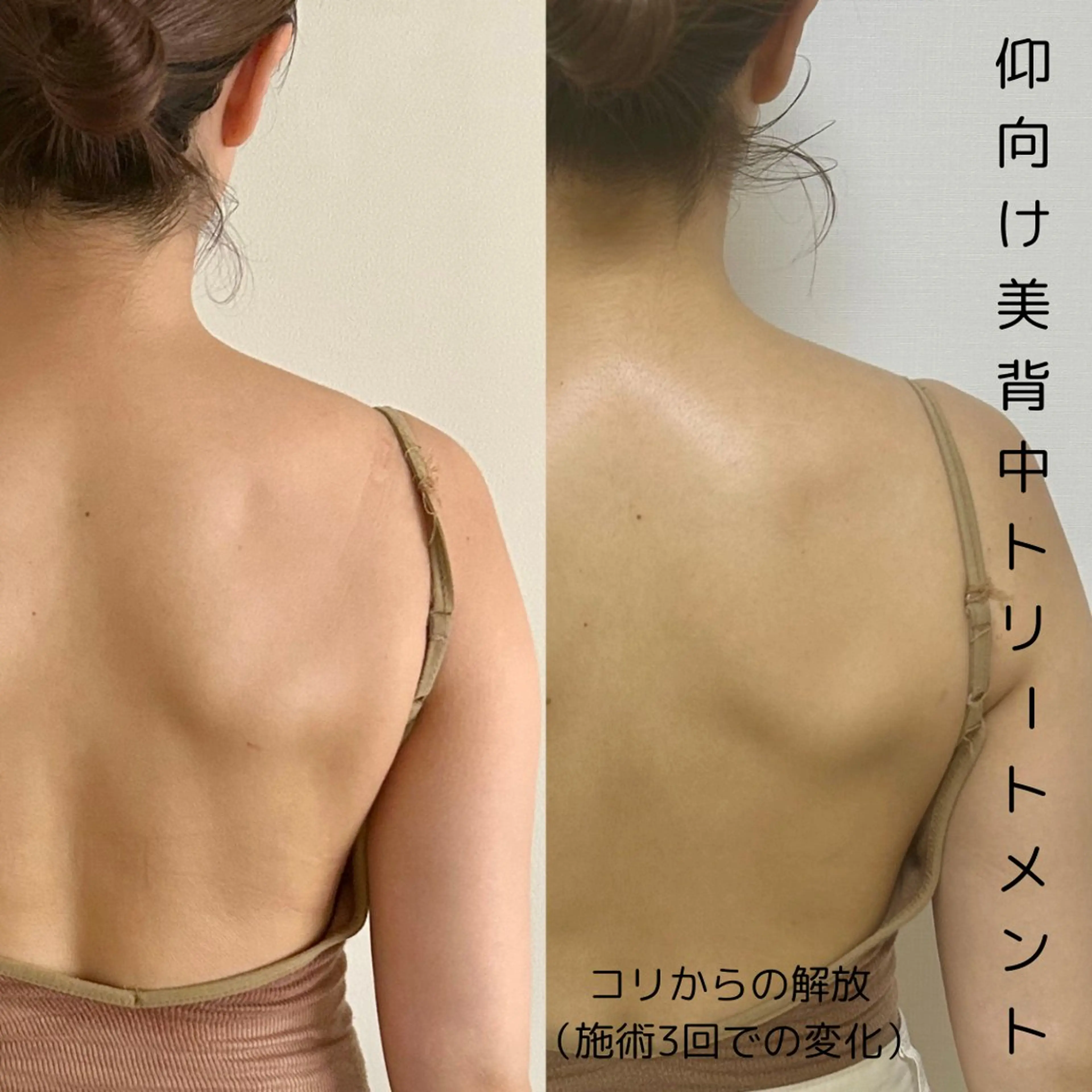 【デブ見えケア】仰向け美背中トリートメントの写真