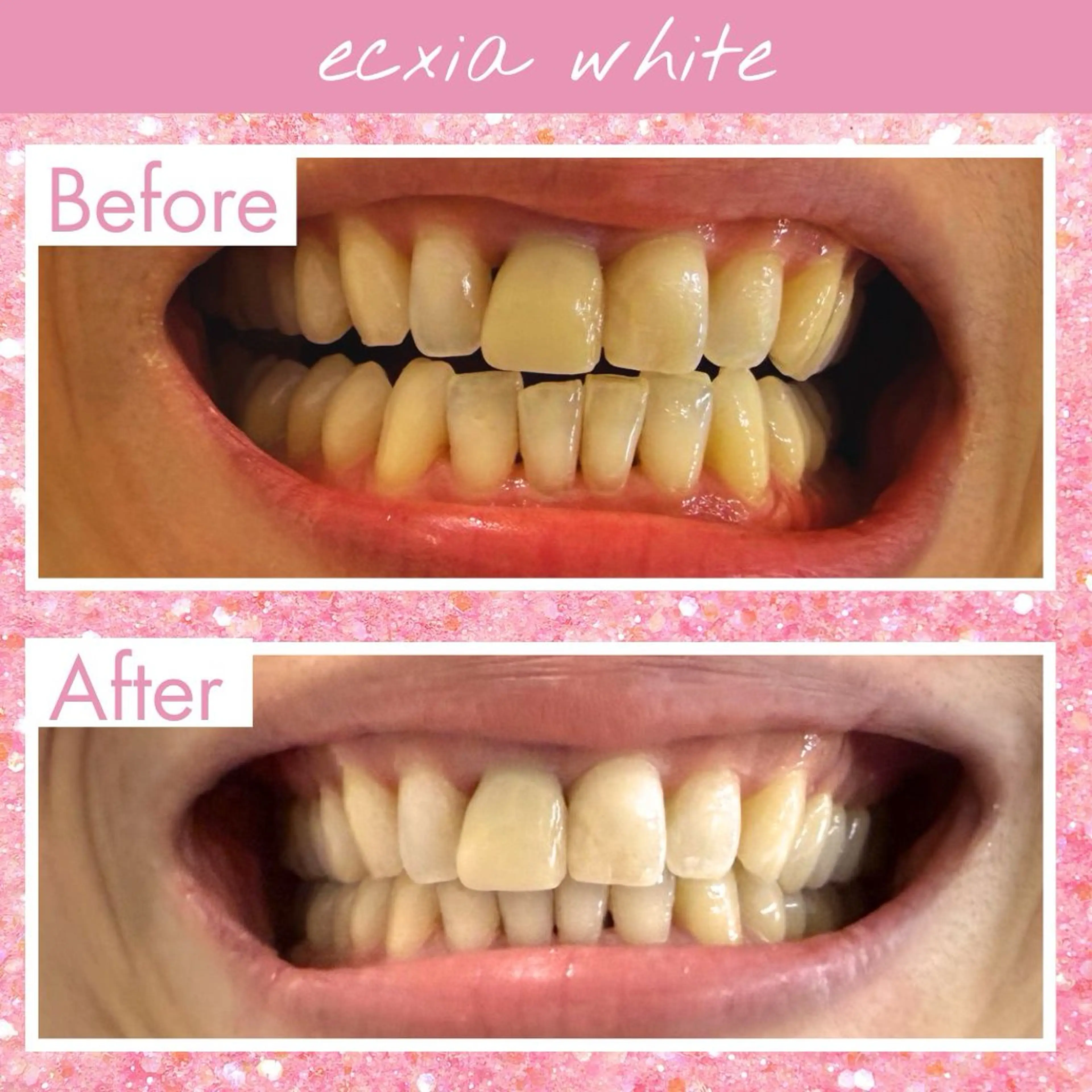 その他 エクシアホワイト福岡六本松所属・喜多 美佳のその他イメージ