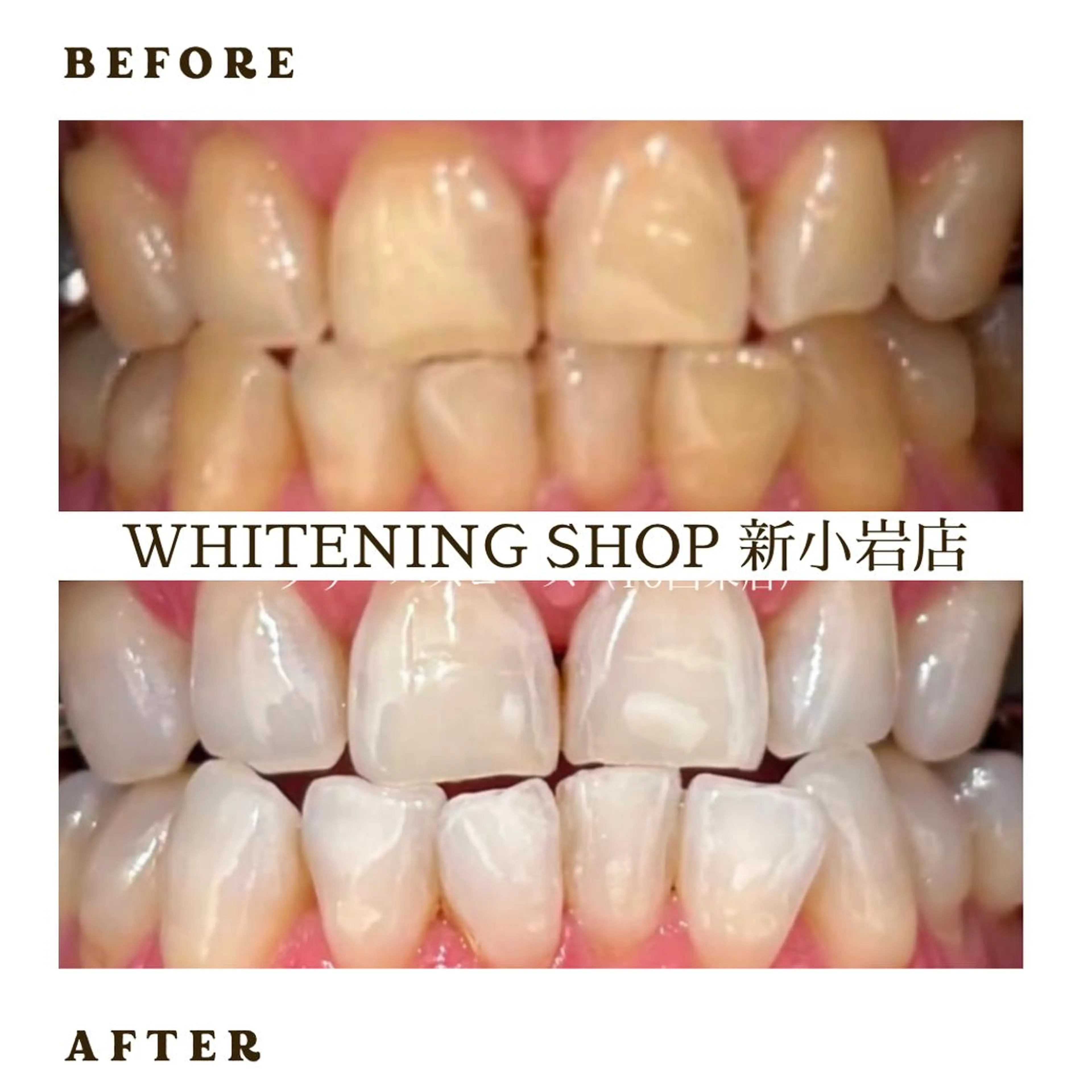 メンズ その他 ホワイトニング ショップ新小岩店のその他イメージ