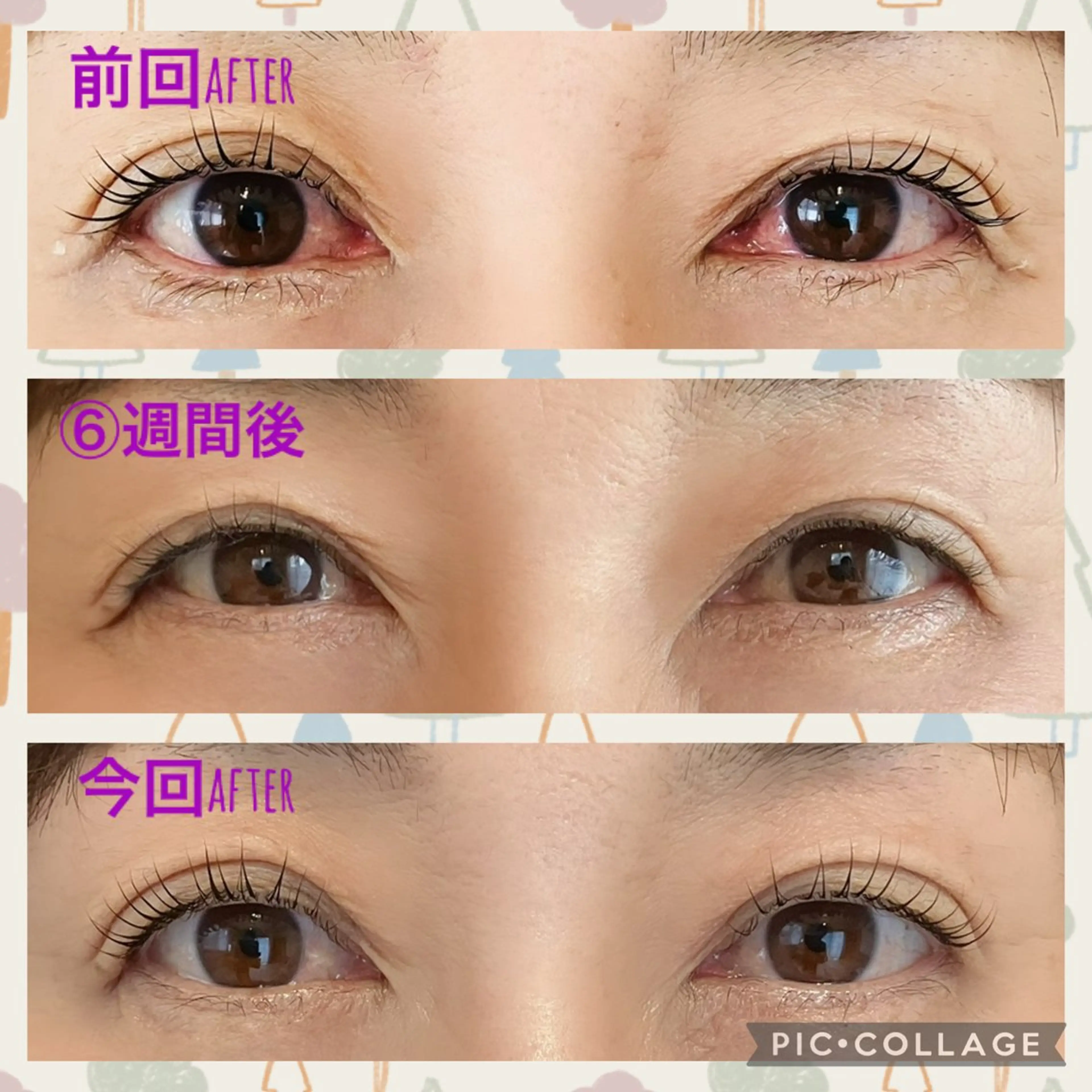 マツエク・マツパ Matricaria AKIのマツエク・マツパデザイン