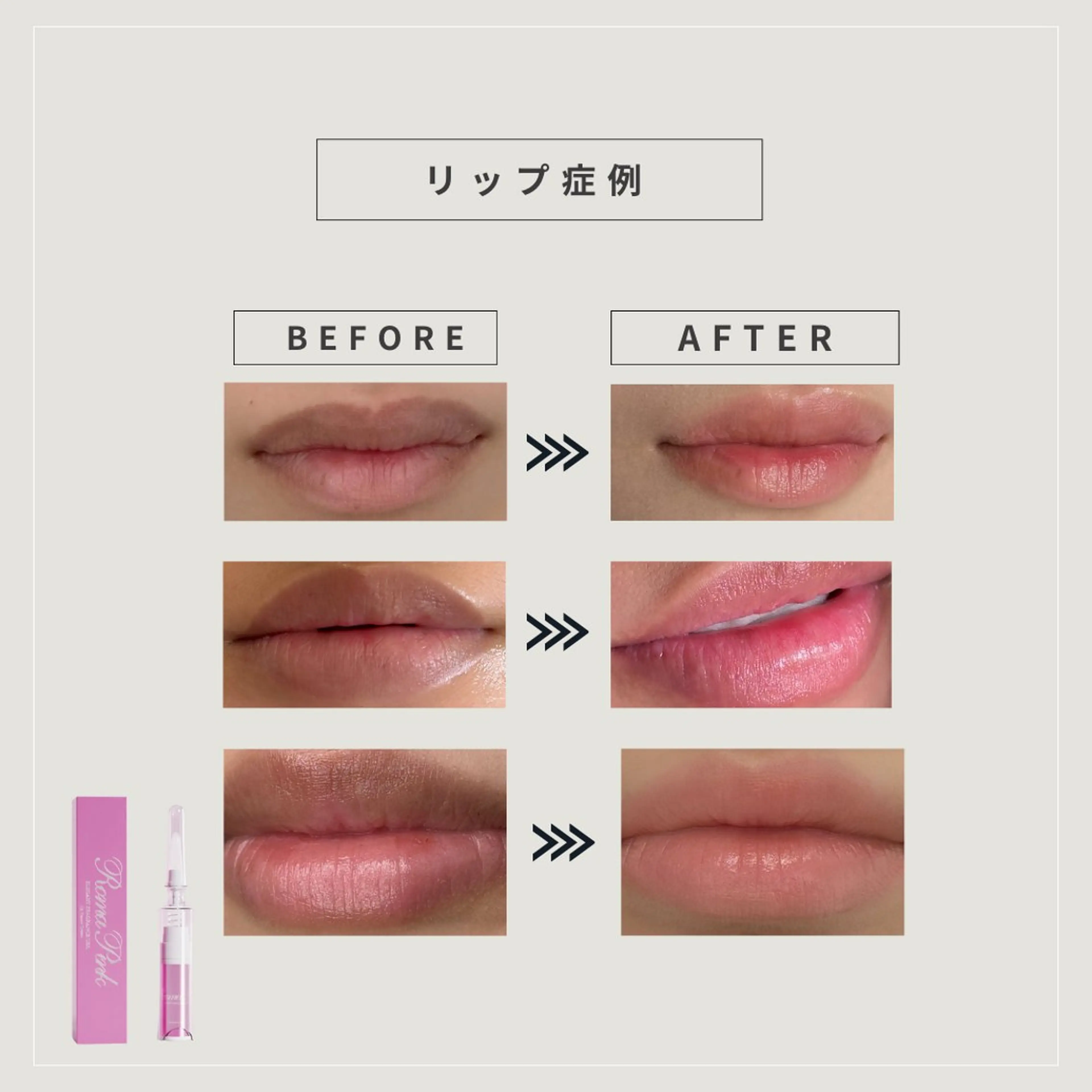 本気で痩せたい方へ 痩身専門サロンのエステ・リラクイメージ