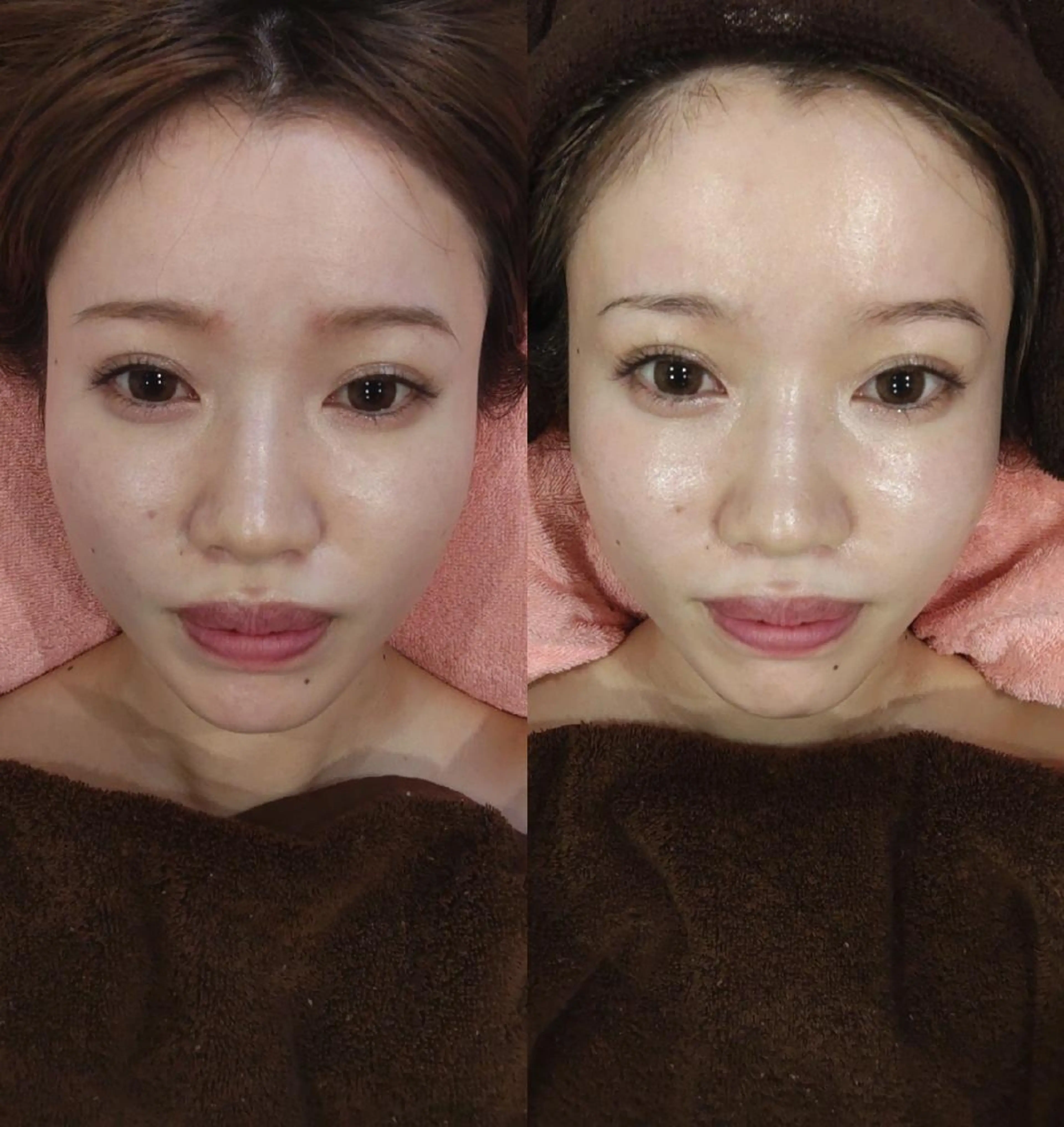 ソリーシェ鍼灸院 上野・稲荷町のエステ・リラクイメージ