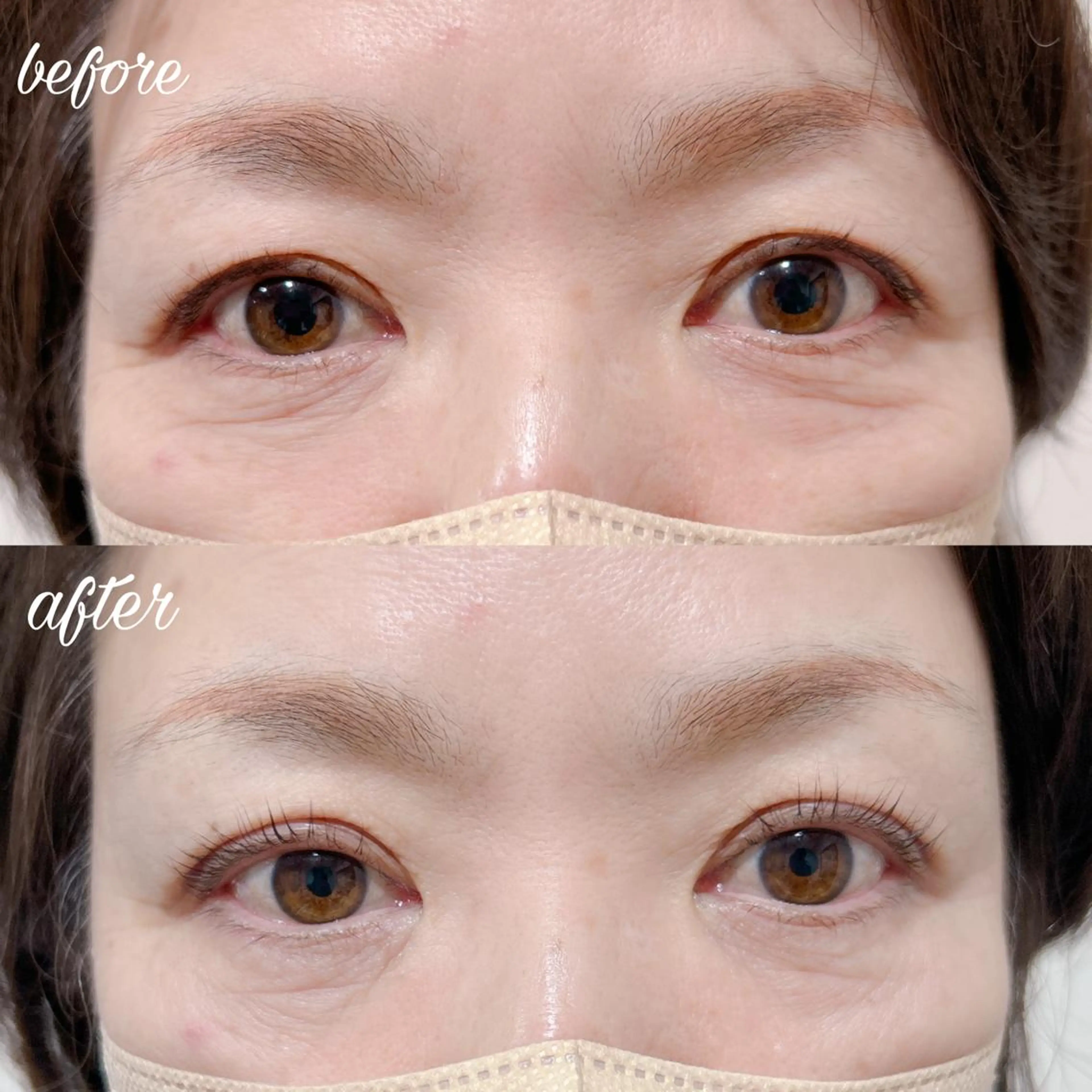 マツエク・マツパ マツパ merveilles所属・まつげ/整体/にきび ・アトピー専門サロンのマツエク・マツパデザイン