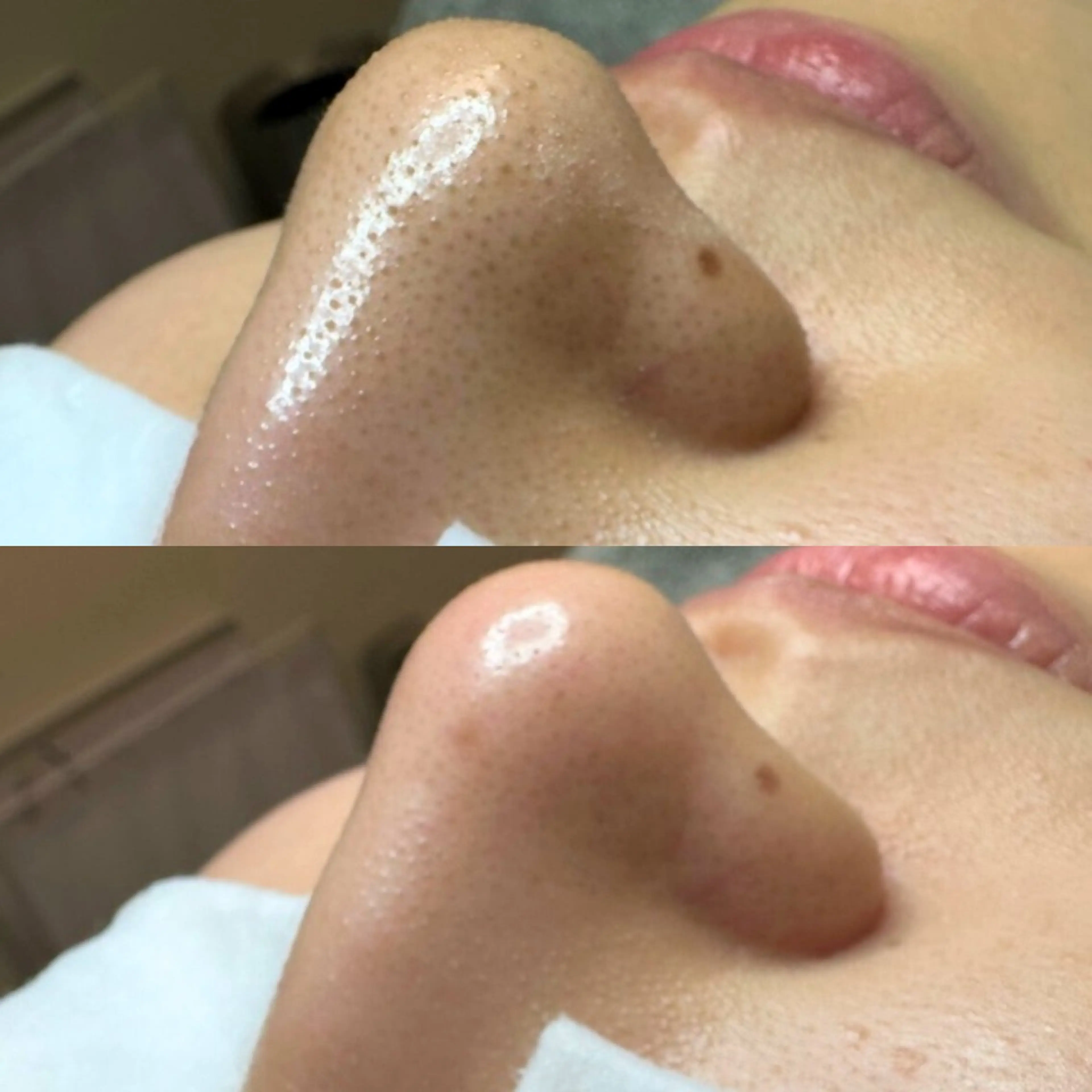 エステ 毛穴ケア特化専門店 トネア自由が丘店のエステ・リラクイメージ