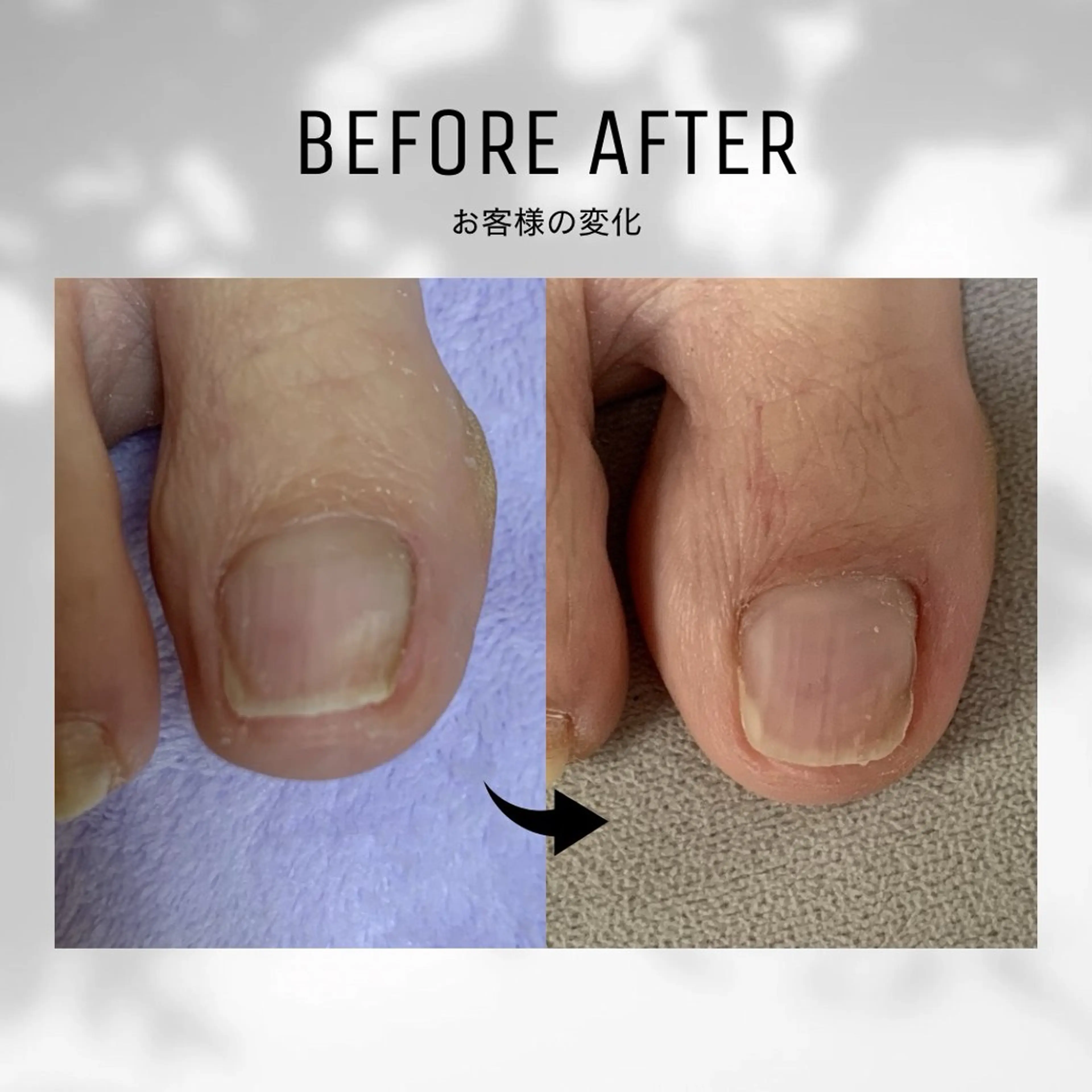 【足トラブル専門店】魚の目・巻き爪 フットケアサロン　ニコルル金沢店所属・足トラブル専門 ニコルル金沢のエステ・リラクイメージ
