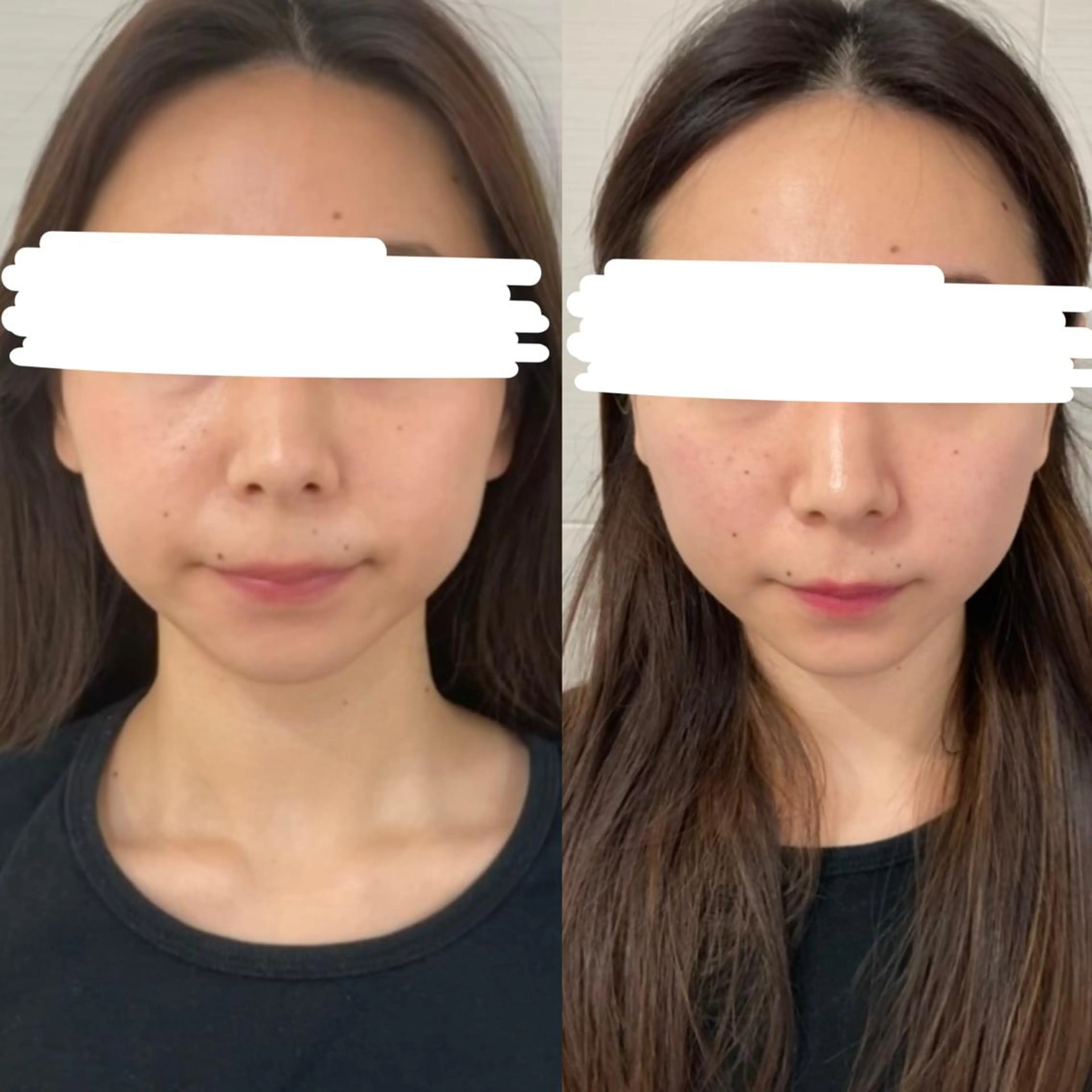 美顔をDESIGN 代表Mamoruのエステ・リラクイメージ