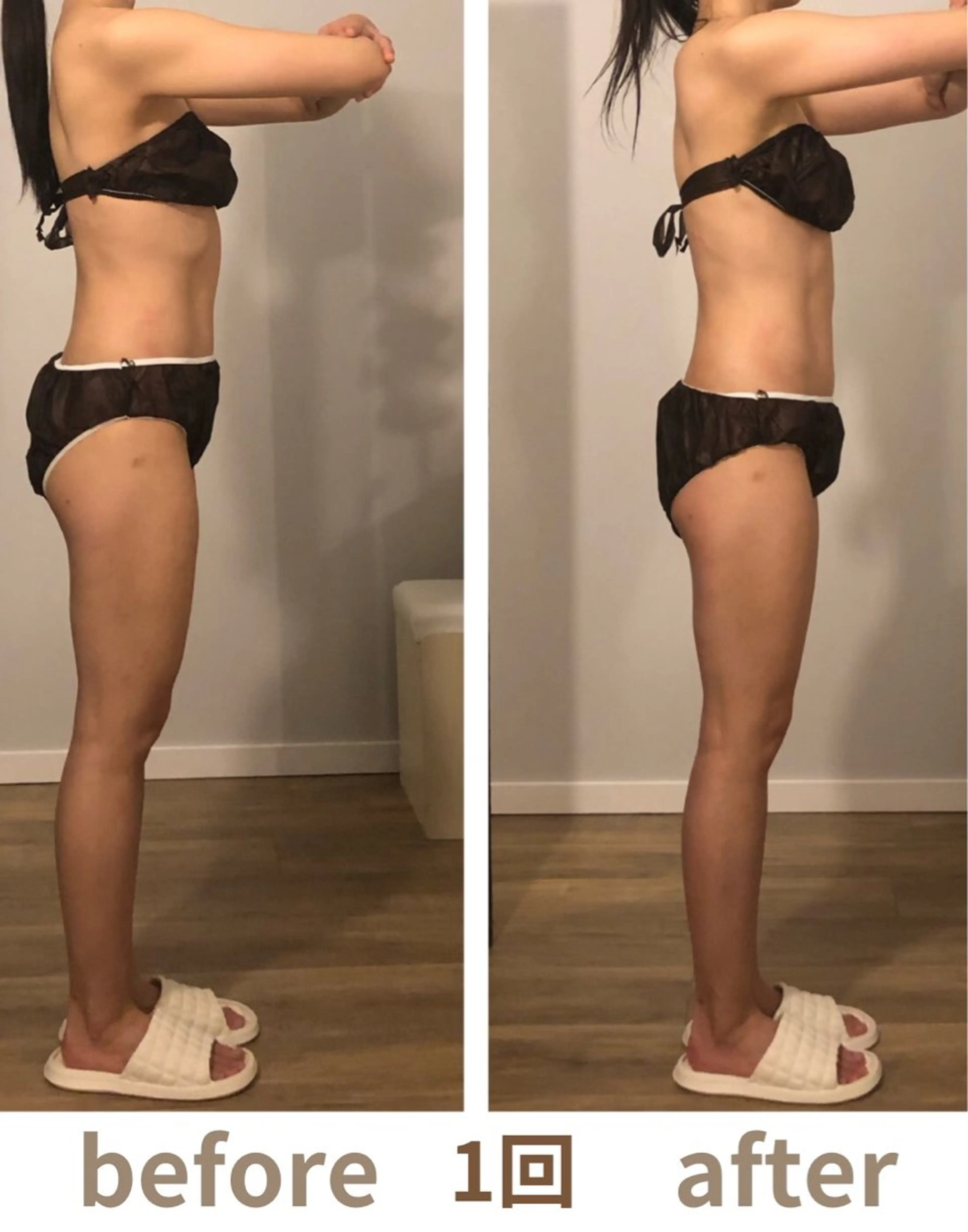 小顔・痩身専門店 Sunao所属・小顔.足痩せ整体 痩身天六Sunaoのその他イメージ