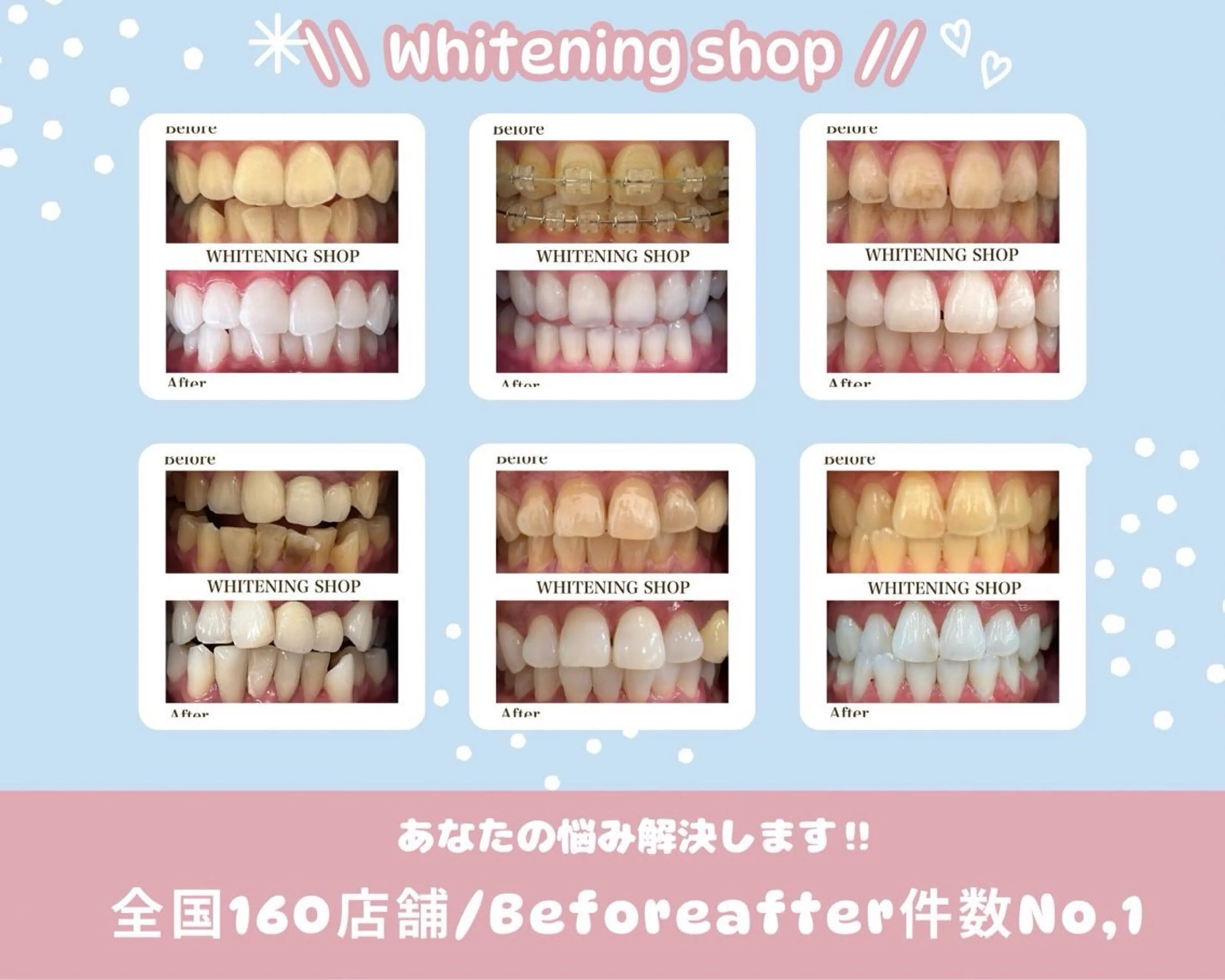 ホワイトニングショップ静岡葵区店所属・ホワイトニング ショップ葵区静岡駅店のその他イメージ