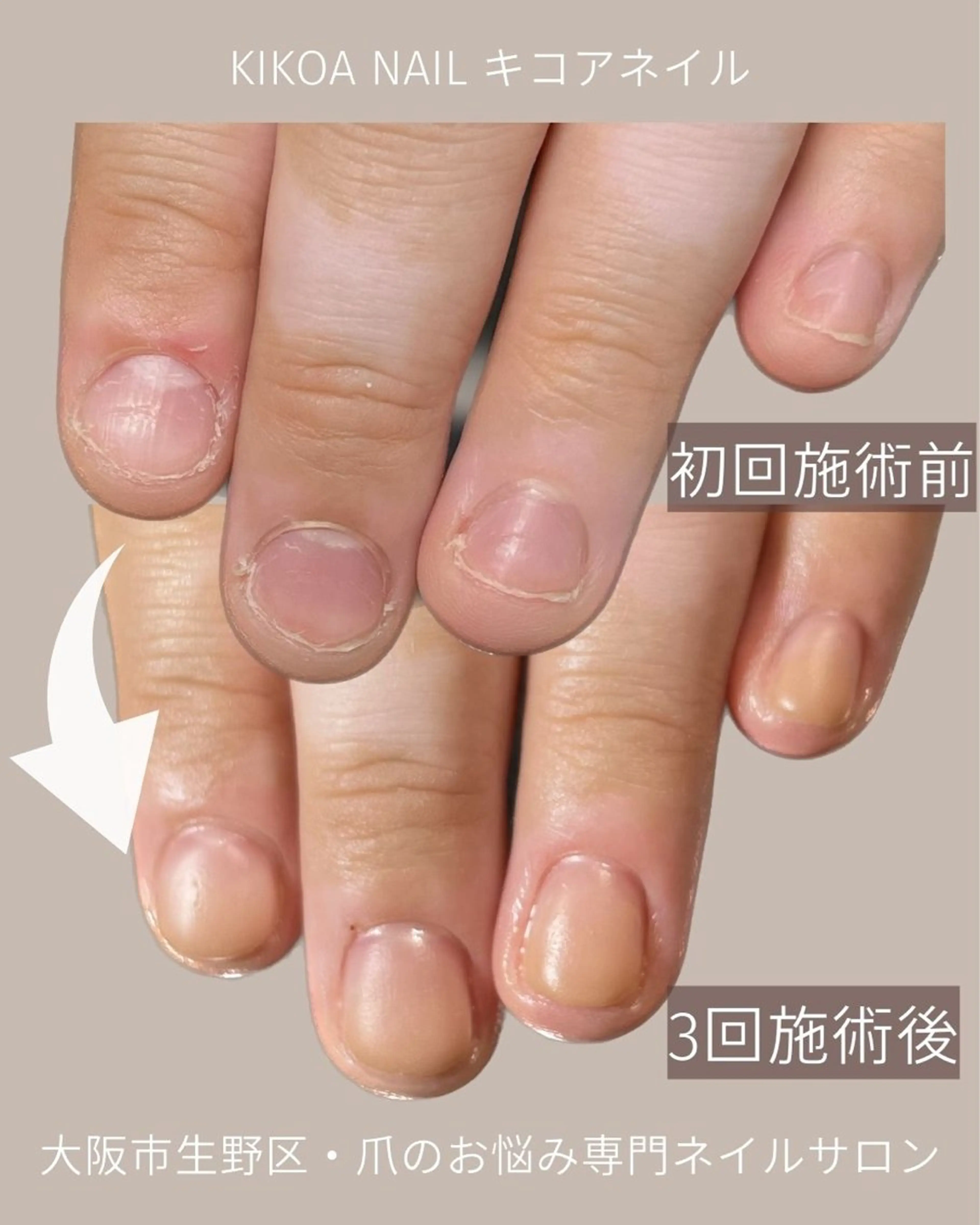 ネイル KIKOA NAIL キコアネイルのネイルデザイン