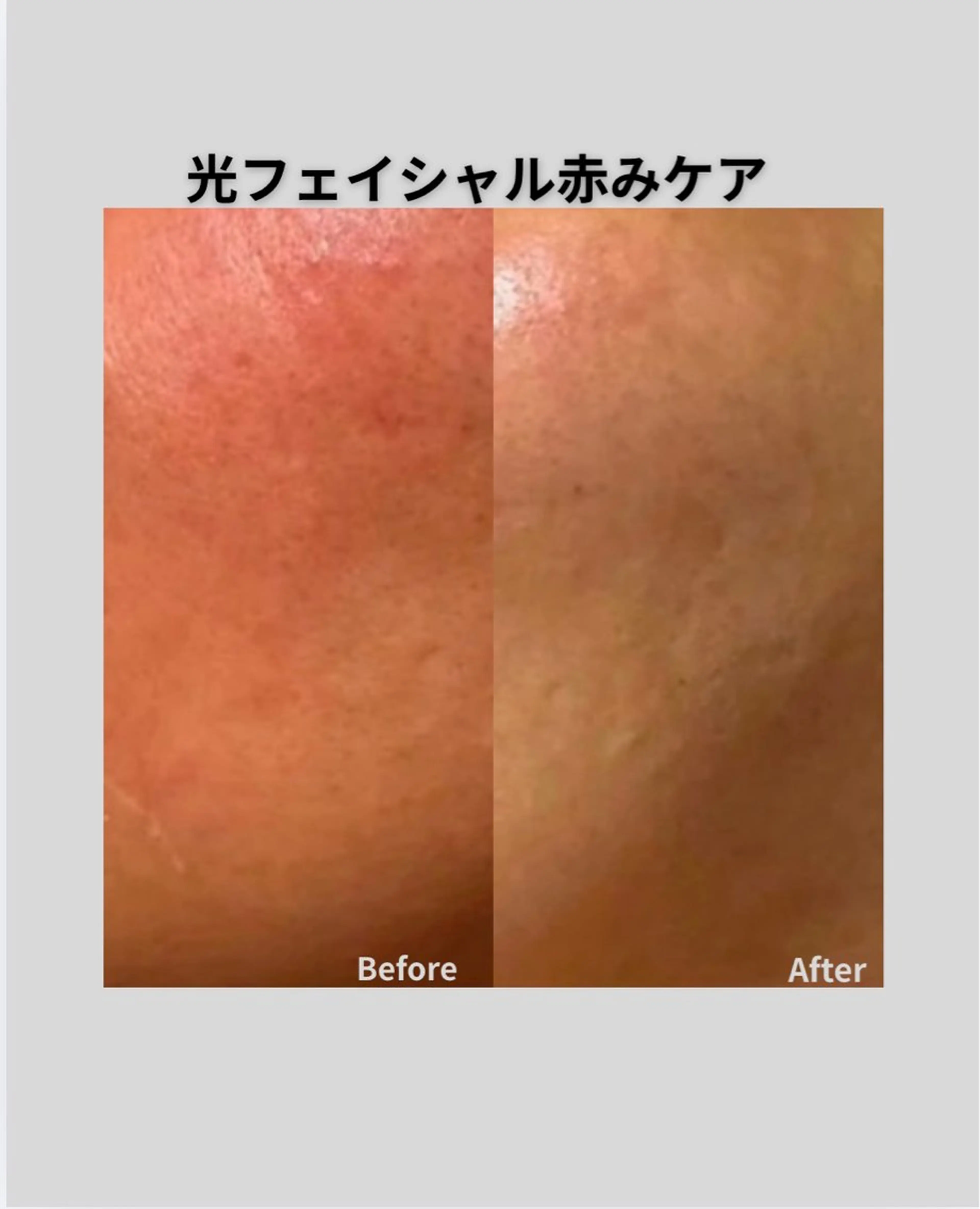 肌管理フェイシャル|Utouto所属・肌管理フェイシャル Utoutoのエステ・リラクイメージ