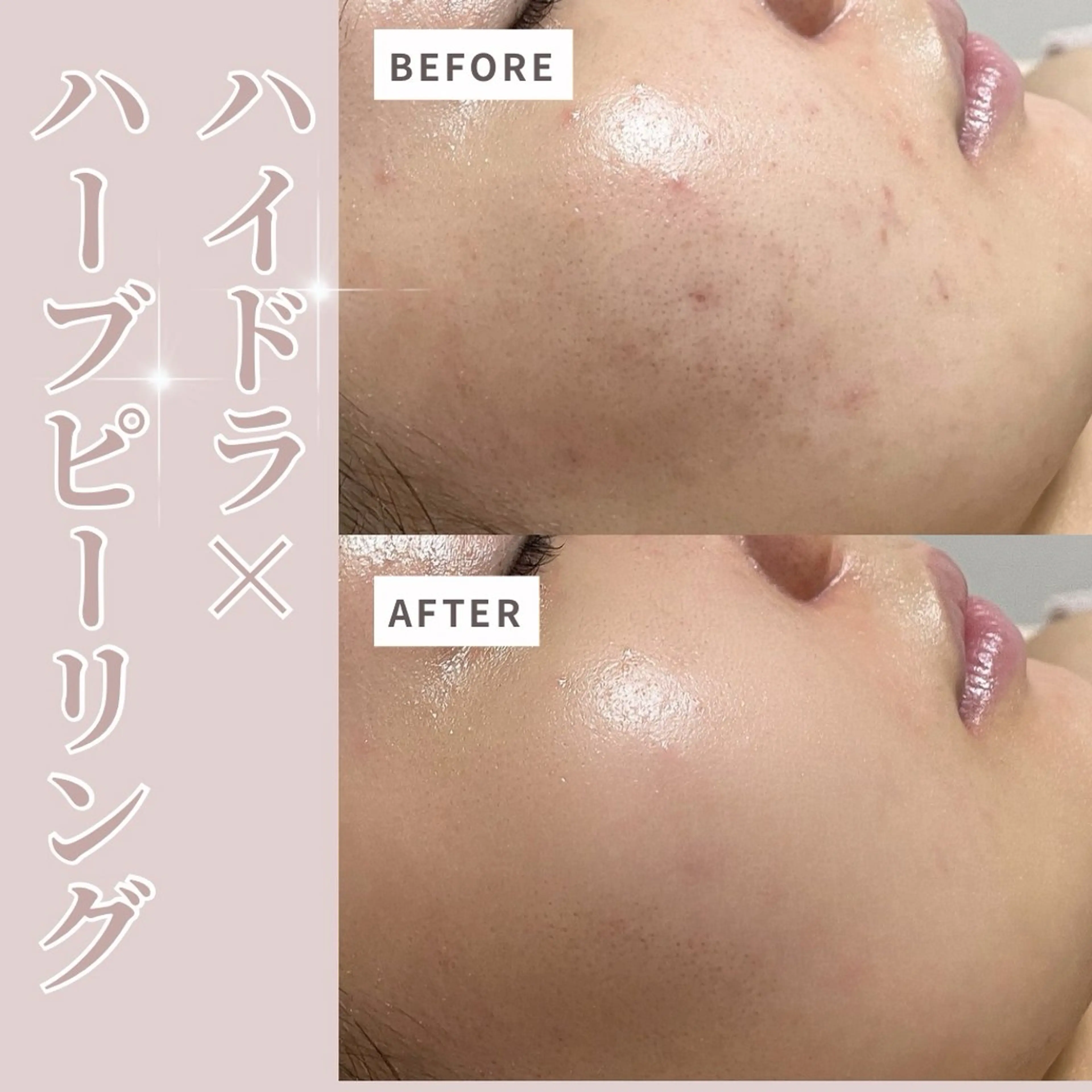 エステ プライベートサロン Belle（ベル）のエステ・リラクイメージ