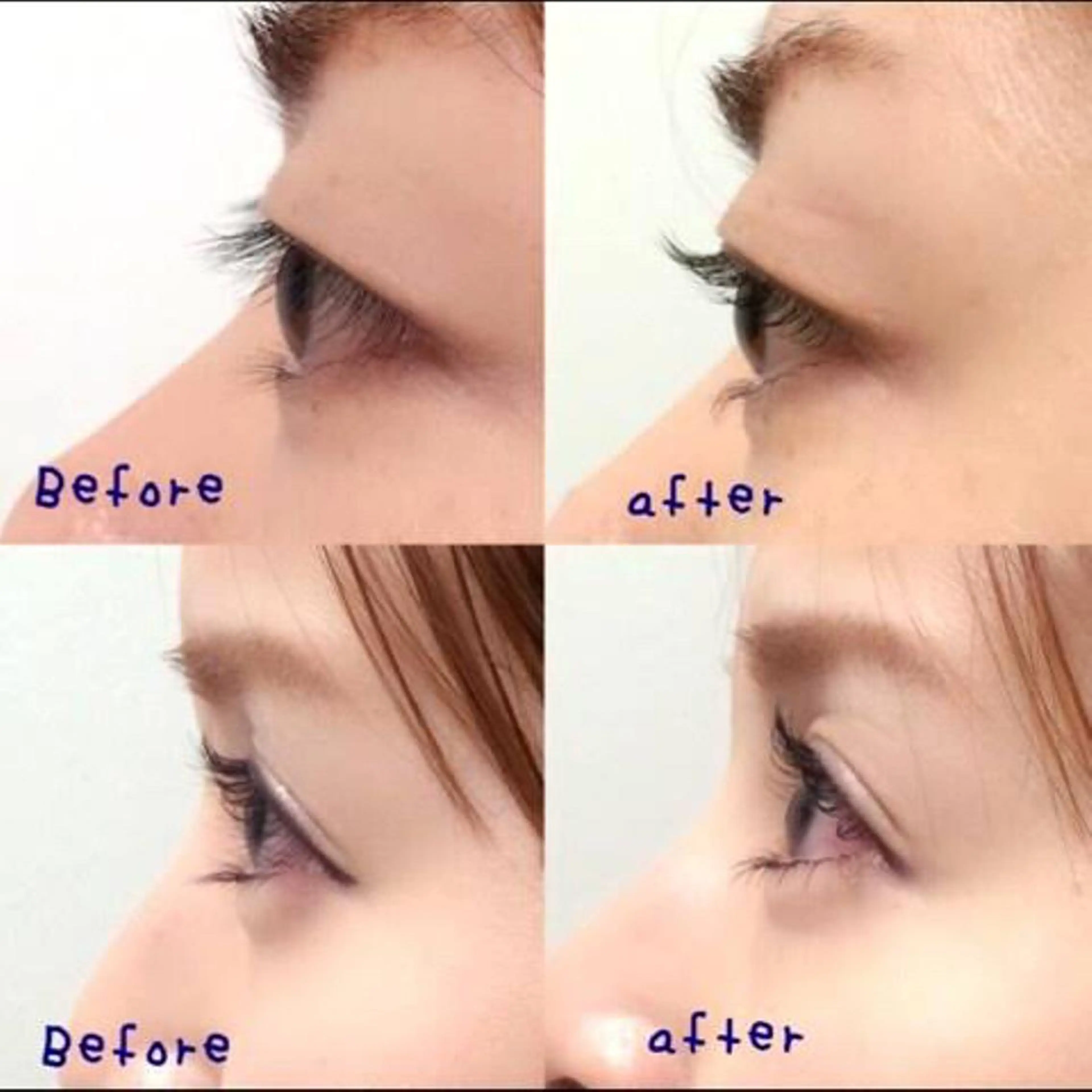 まつ毛パーマ上のみの写真