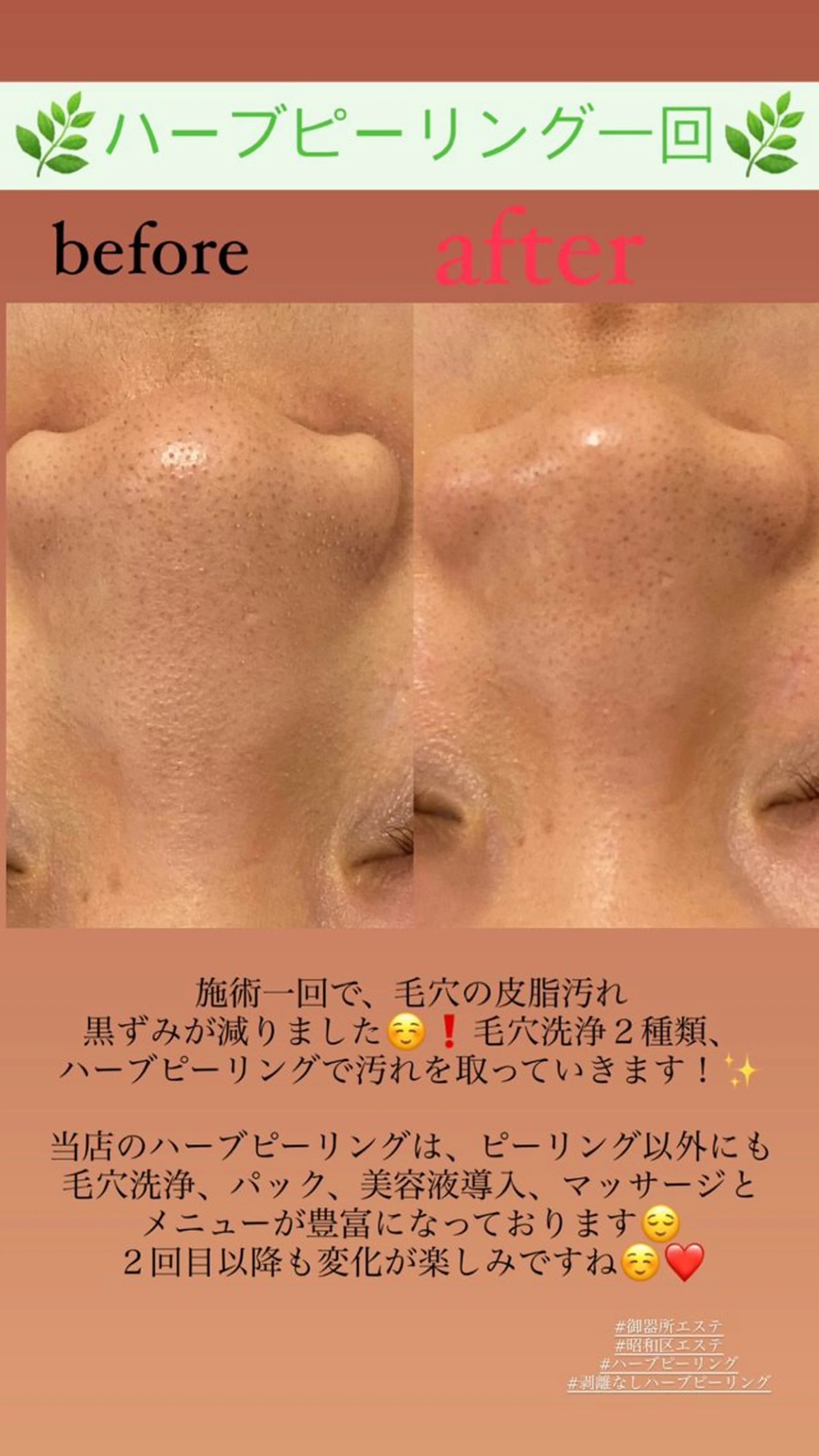 エステ Salon de Lino 御器所のエステ・リラクイメージ