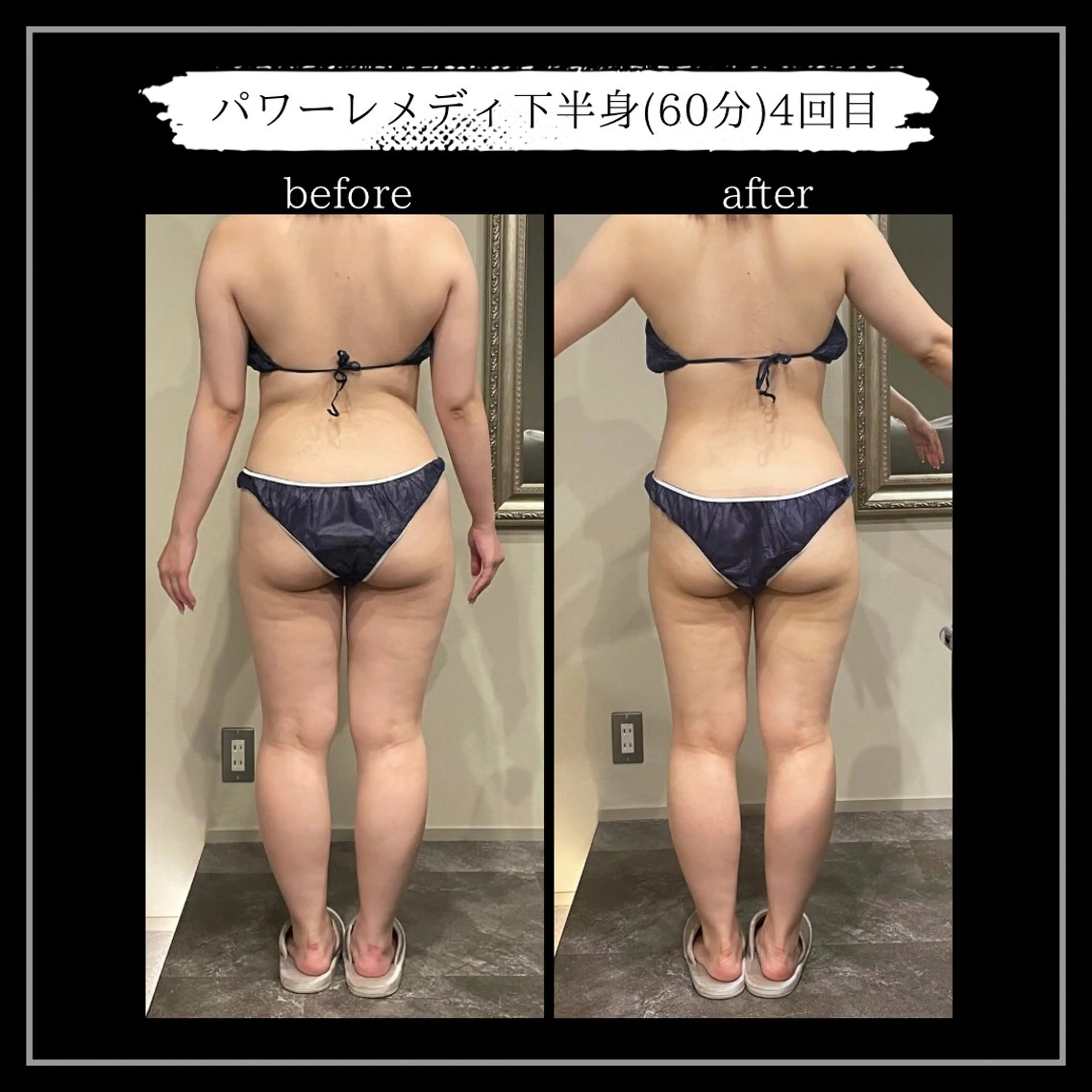 オフ:オン所属・オフ:オン 全身筋膜マッサージのエステ・リラクイメージ