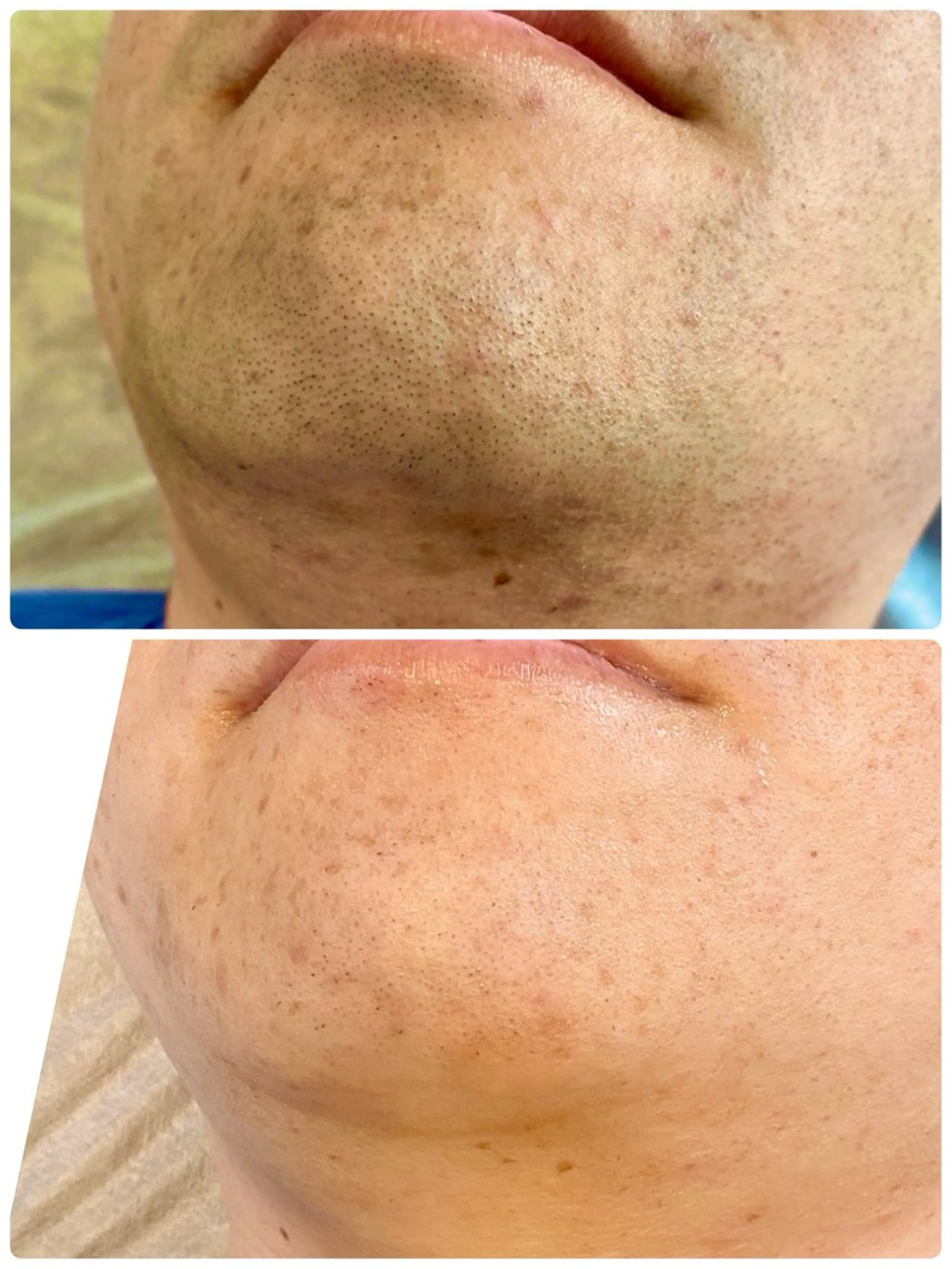 脱毛 脱毛・エステサロン LuLuNのエステ・リラクイメージ