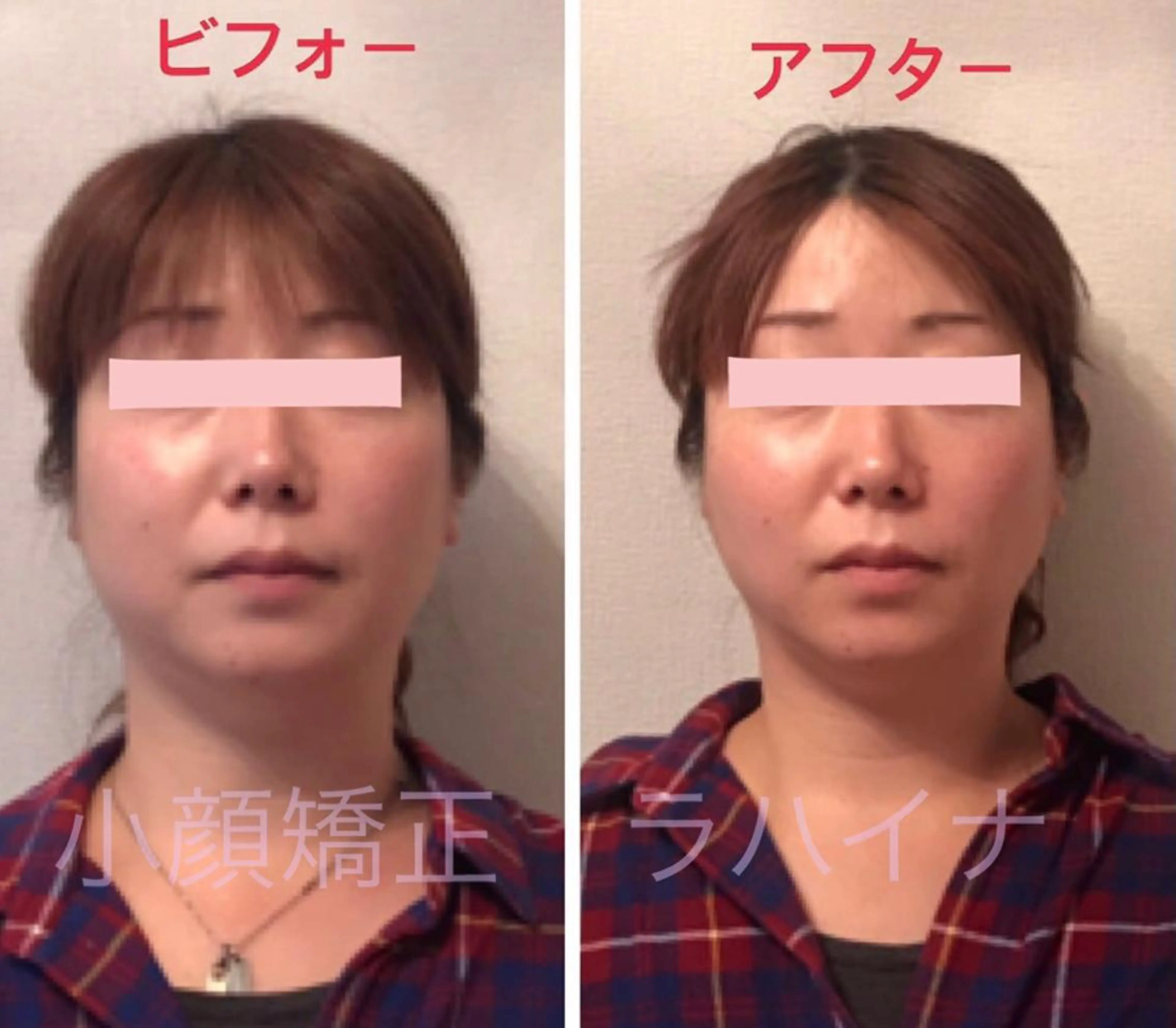 エステ リラク 小顔矯正＆ロミロミ ラハイナ所属・小顔矯正 ラハイナのエステ・リラクイメージ