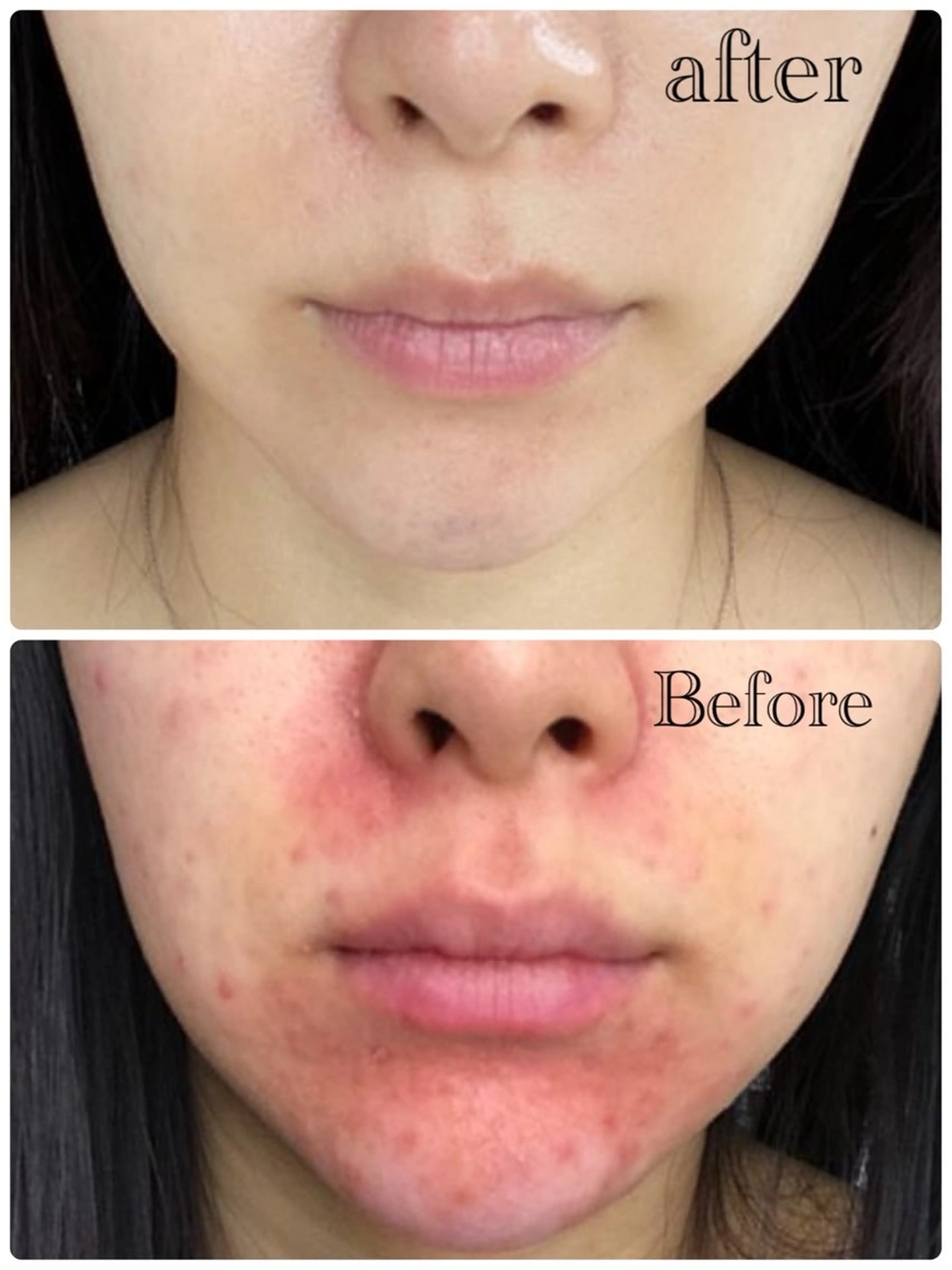 Nao Fukuoka/healingforceN所属・野中 康子のエステ・リラクイメージ