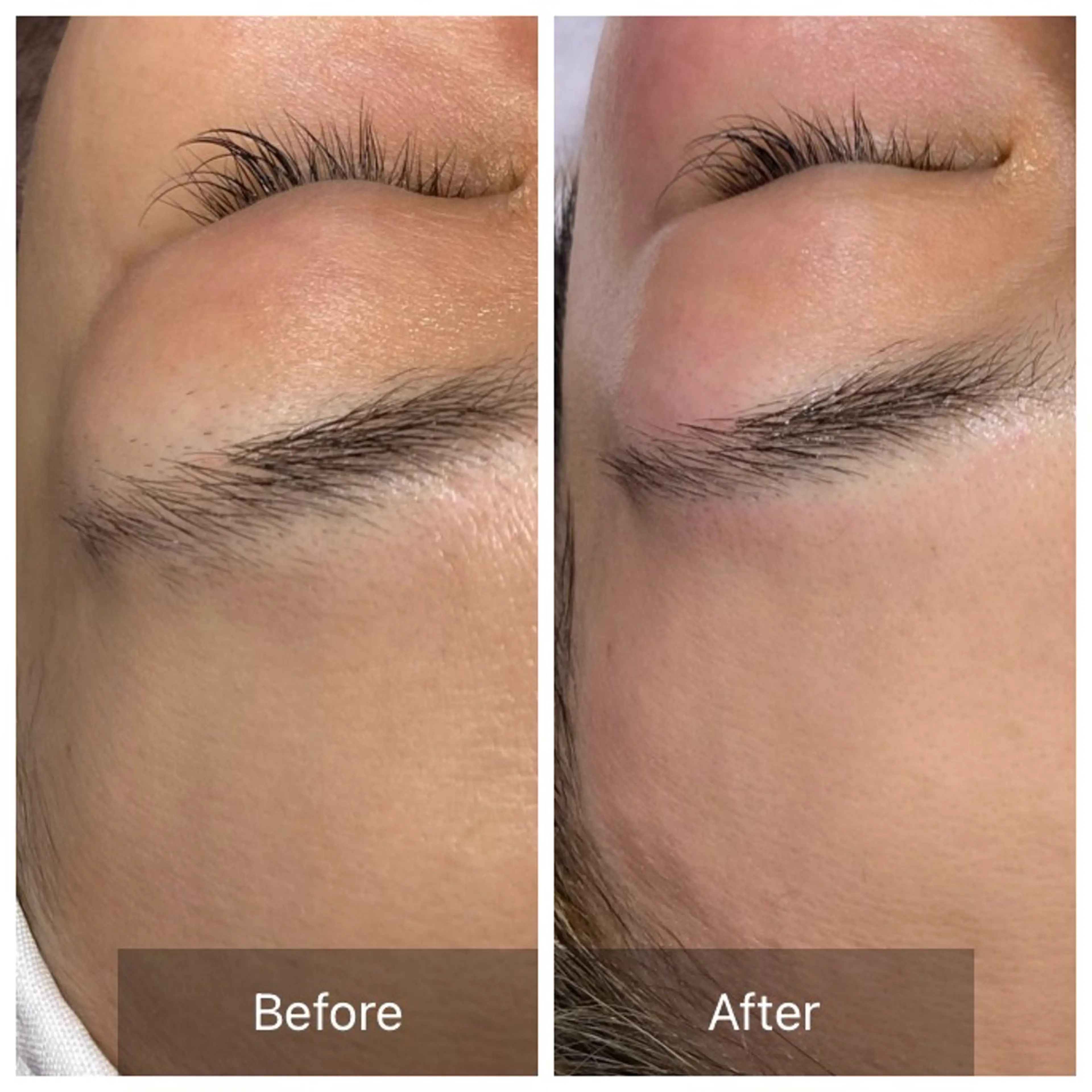 脱毛 産毛専門店 Bittoのエステ・リラクイメージ