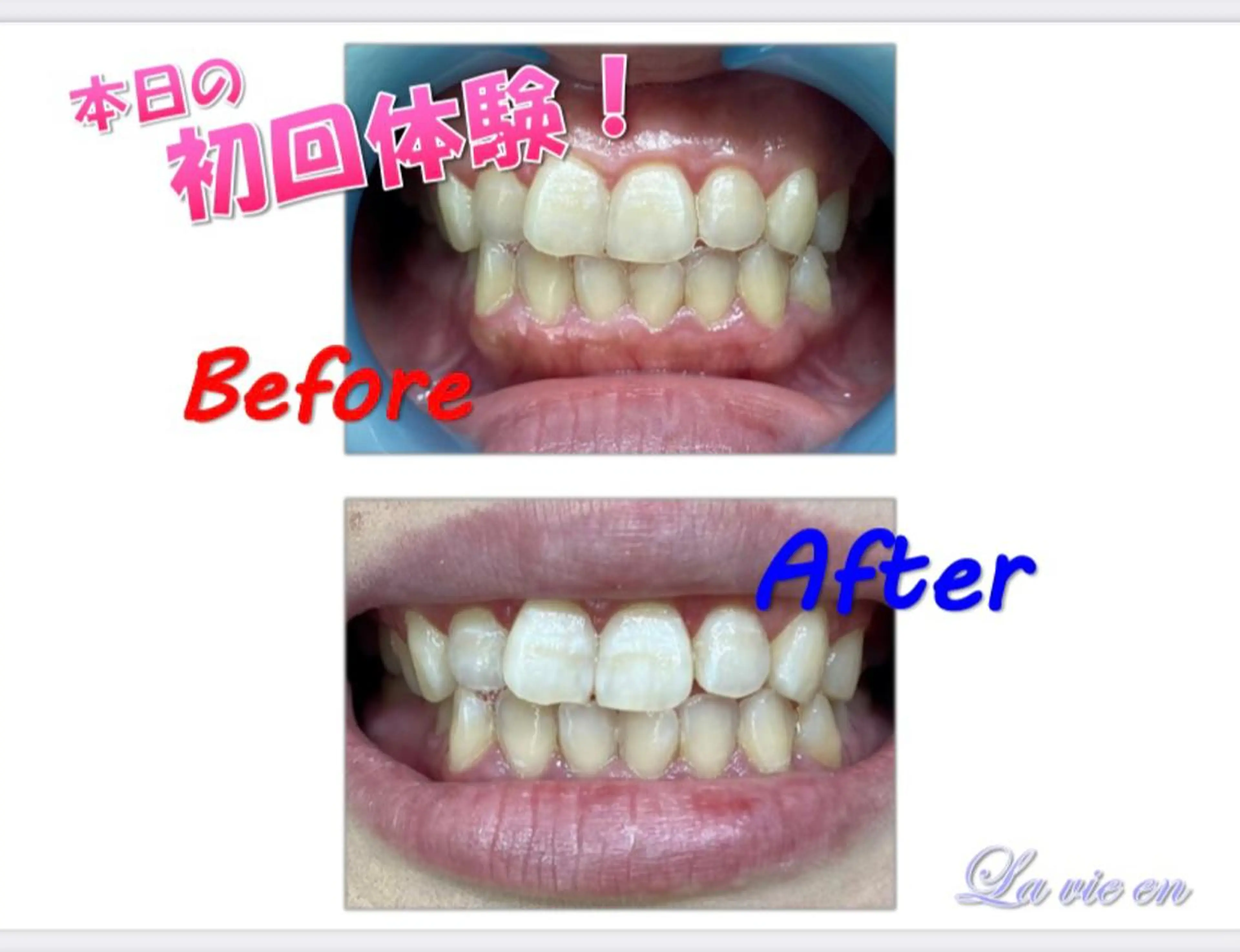 その他 セルフホワイトニングサロン　ラヴィアン所属・ホワイトニングサロン La vie enのその他イメージ