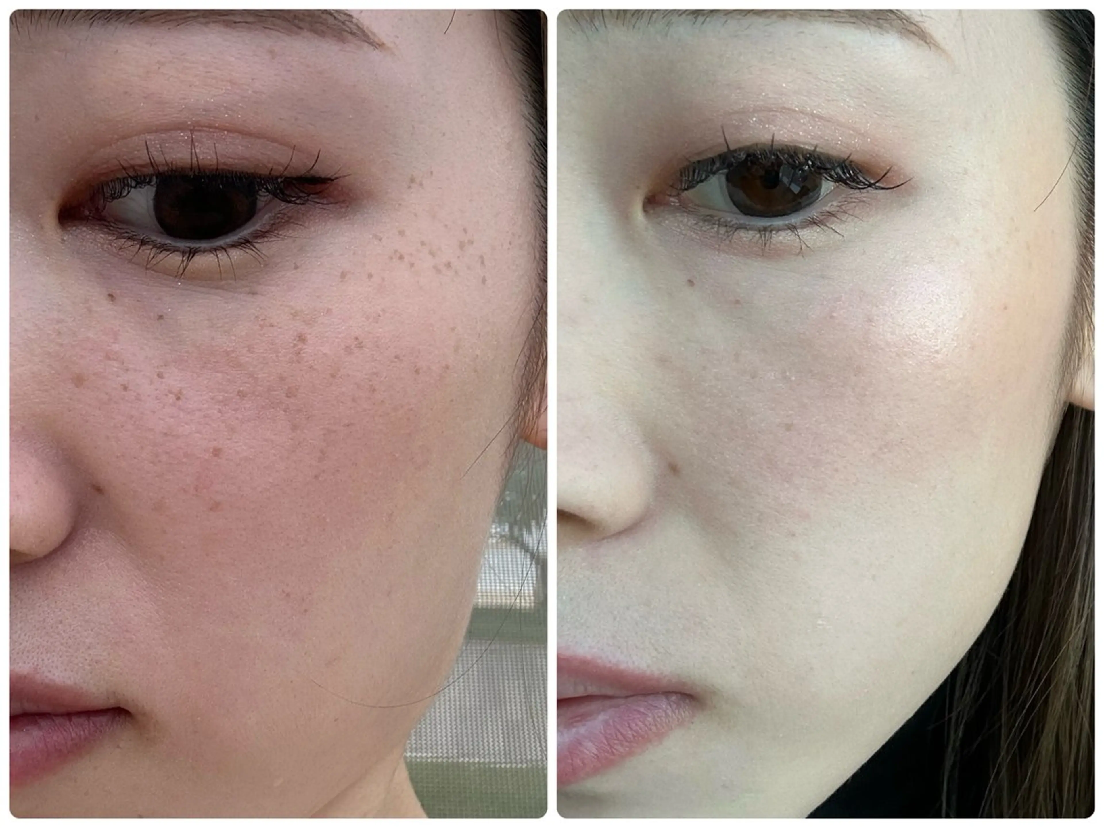 エステ リラク シミ毛穴専門店 yucca(ユッカ)のエステ・リラクイメージ