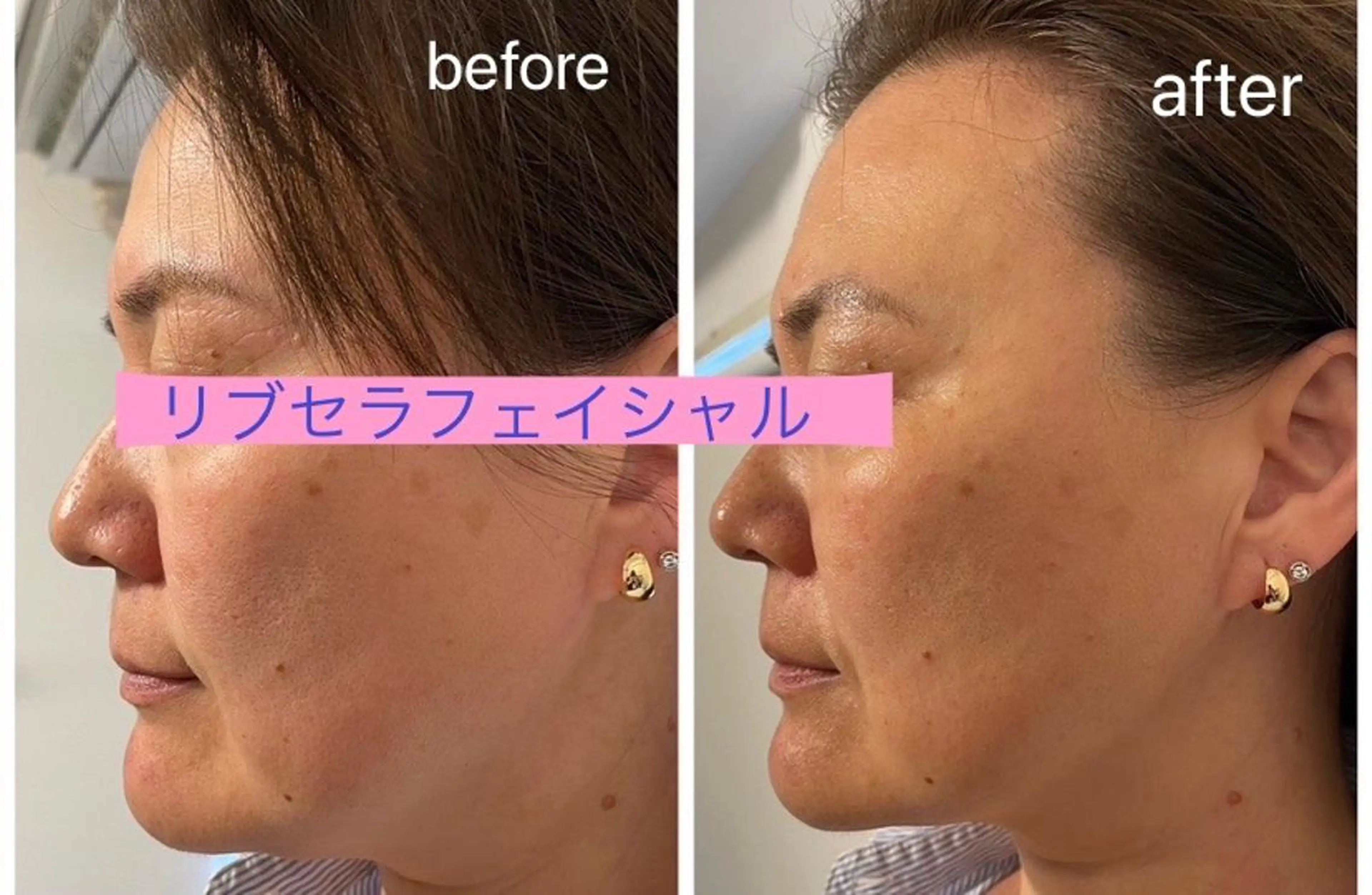 エステ Private Salon Prunelle所属・プライベートサロン プリュネルのエステ・リラクイメージ