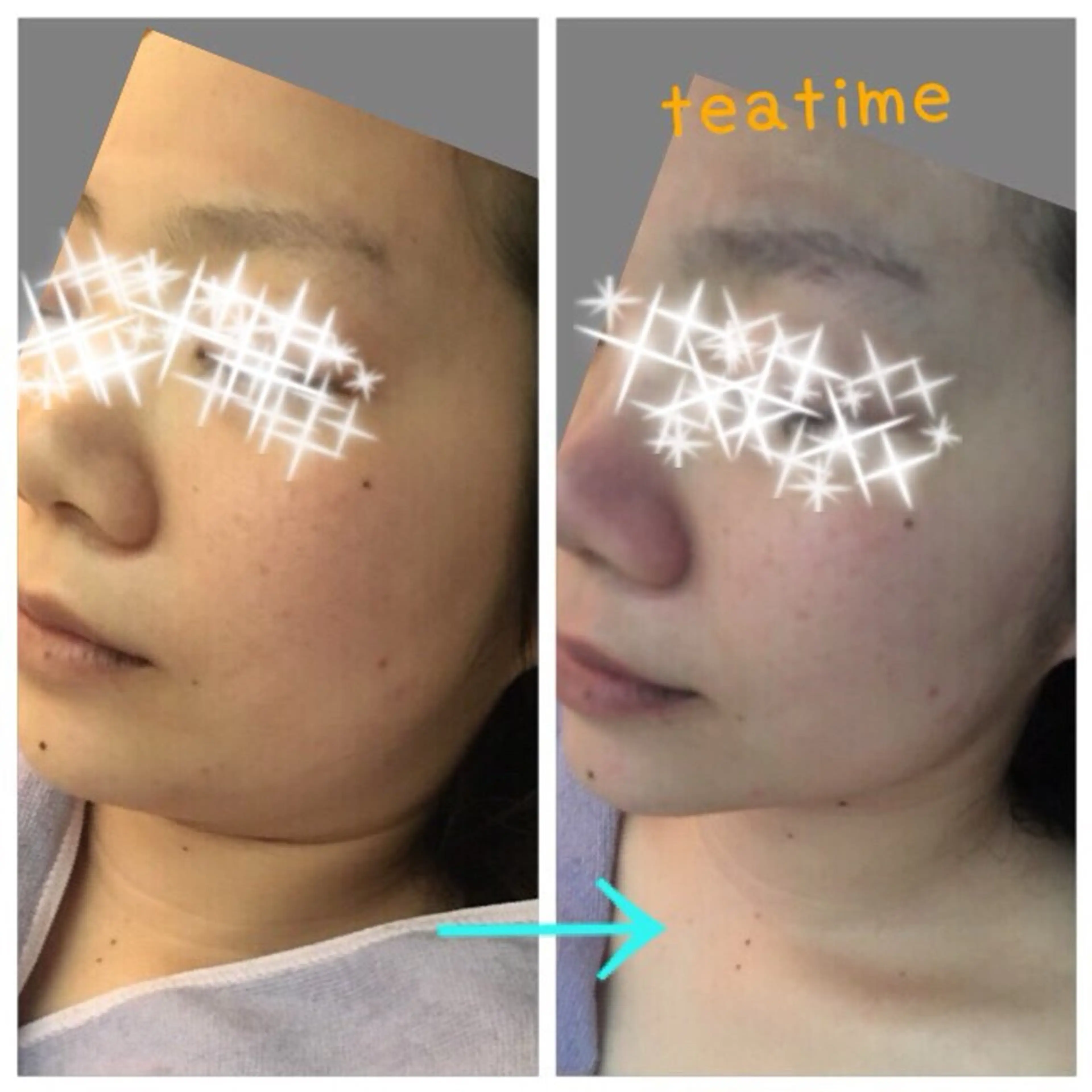 モニター募集　美肌＆整体エステの写真