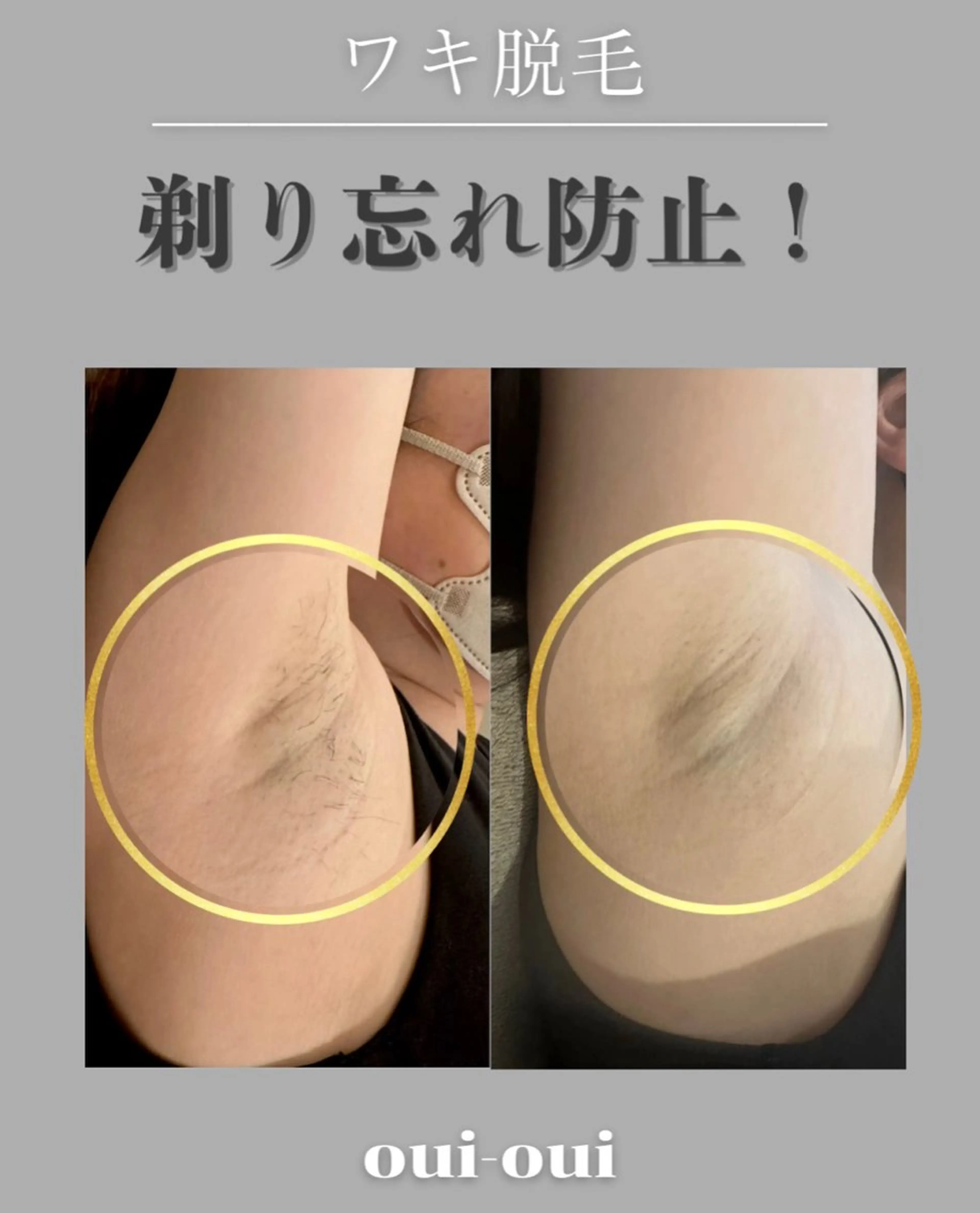 oui-oui　ウィウィ所属・oui-oui 磐田脱毛のエステ・リラクイメージ