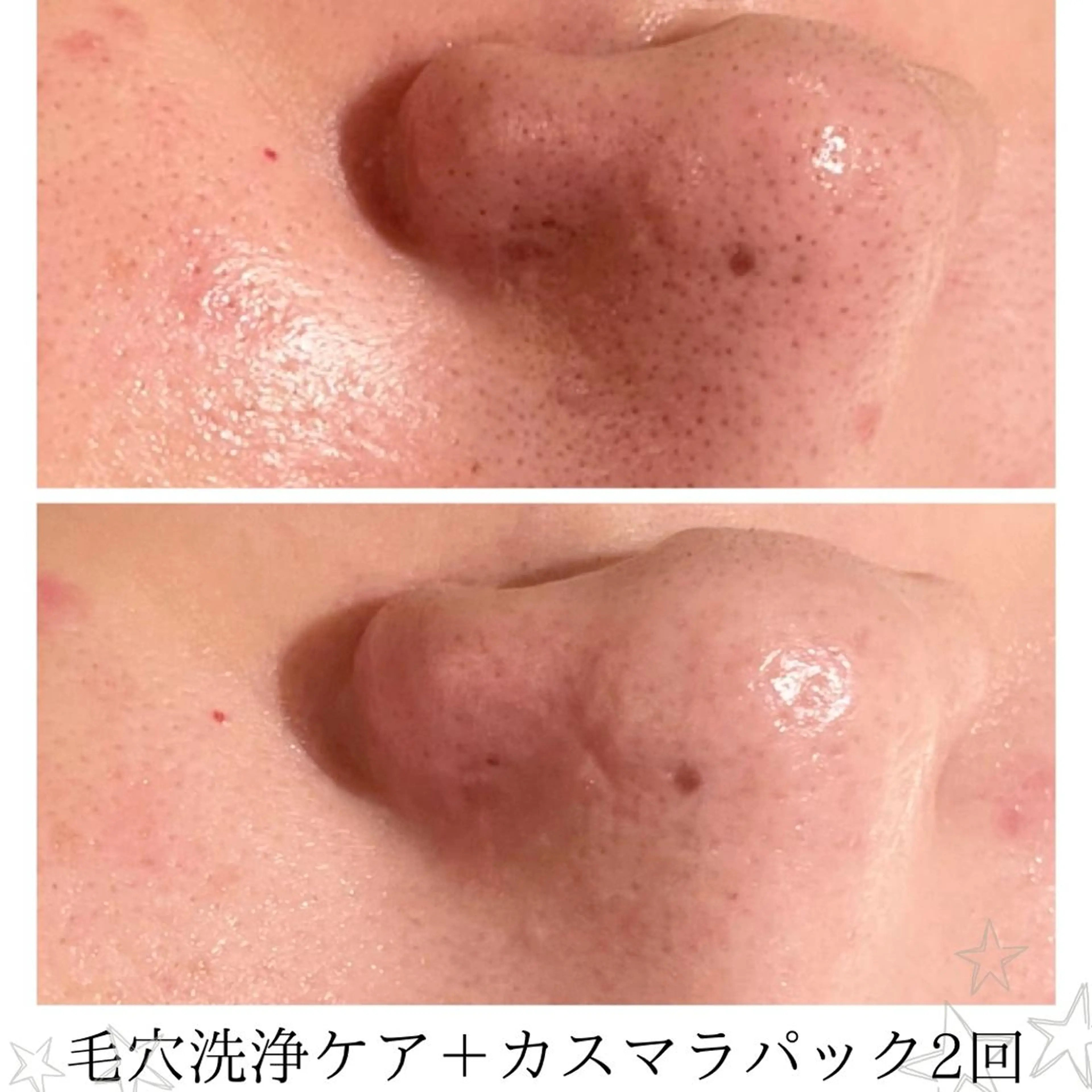 CHERIE所属・CHERIE Hisadaのエステ・リラクイメージ