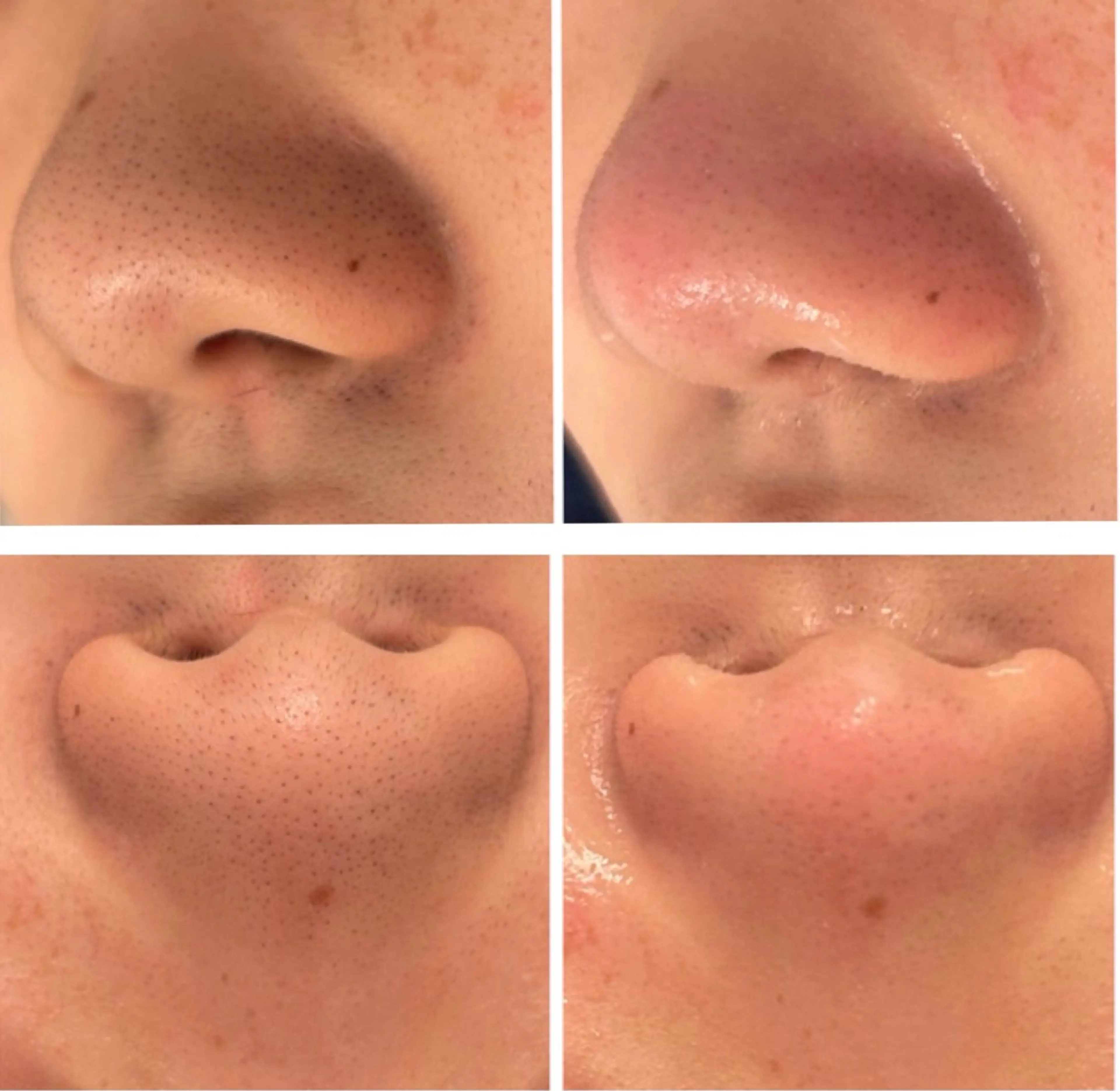 鹿の子台　プライベートサロン　芹花〜SERIKA〜所属・稲角 芹香のエステ・リラクイメージ