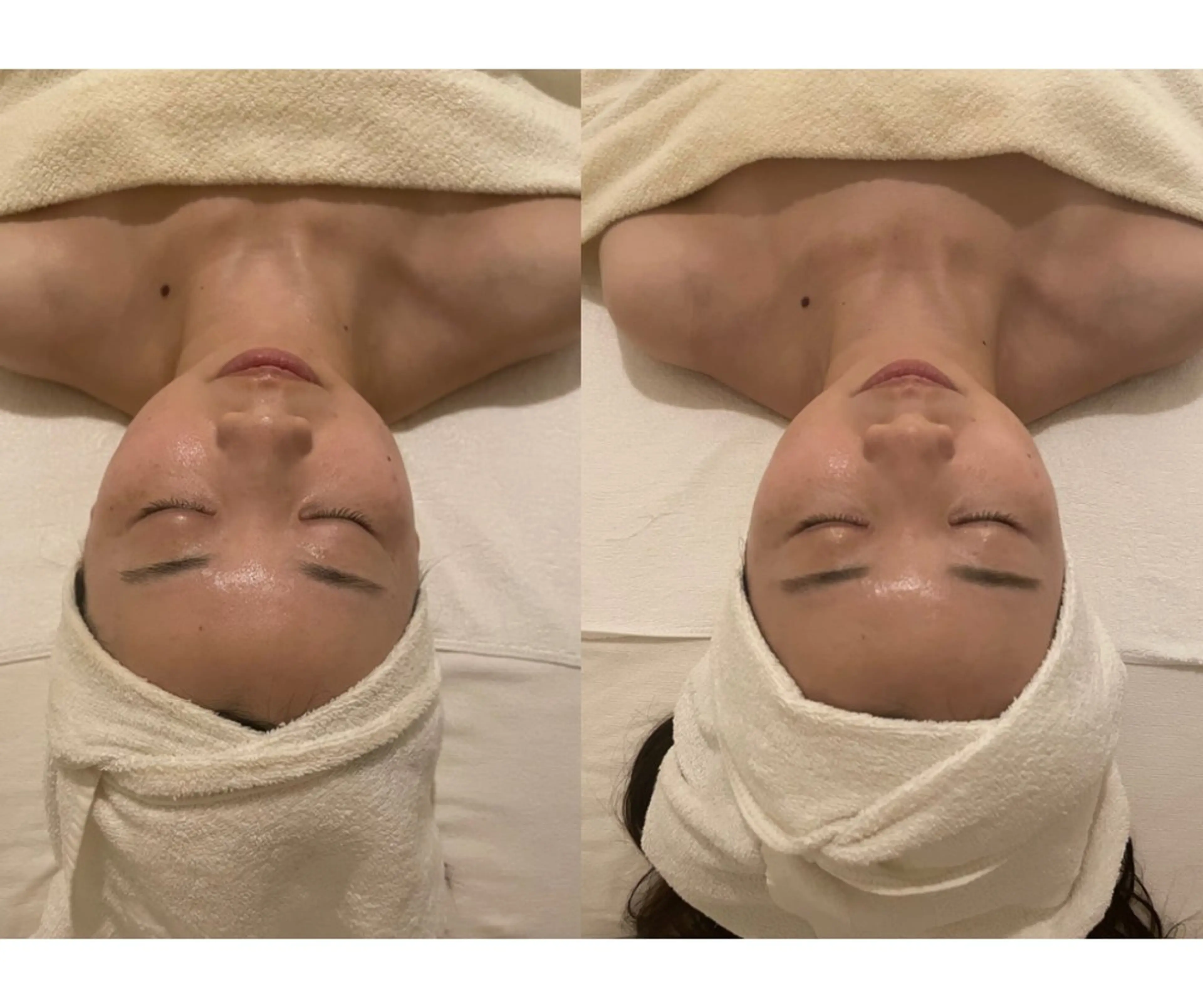 小顔/リンパ/マッサージL.sana所属・小顔/フェイシャル L.sanaのエステ・リラクイメージ