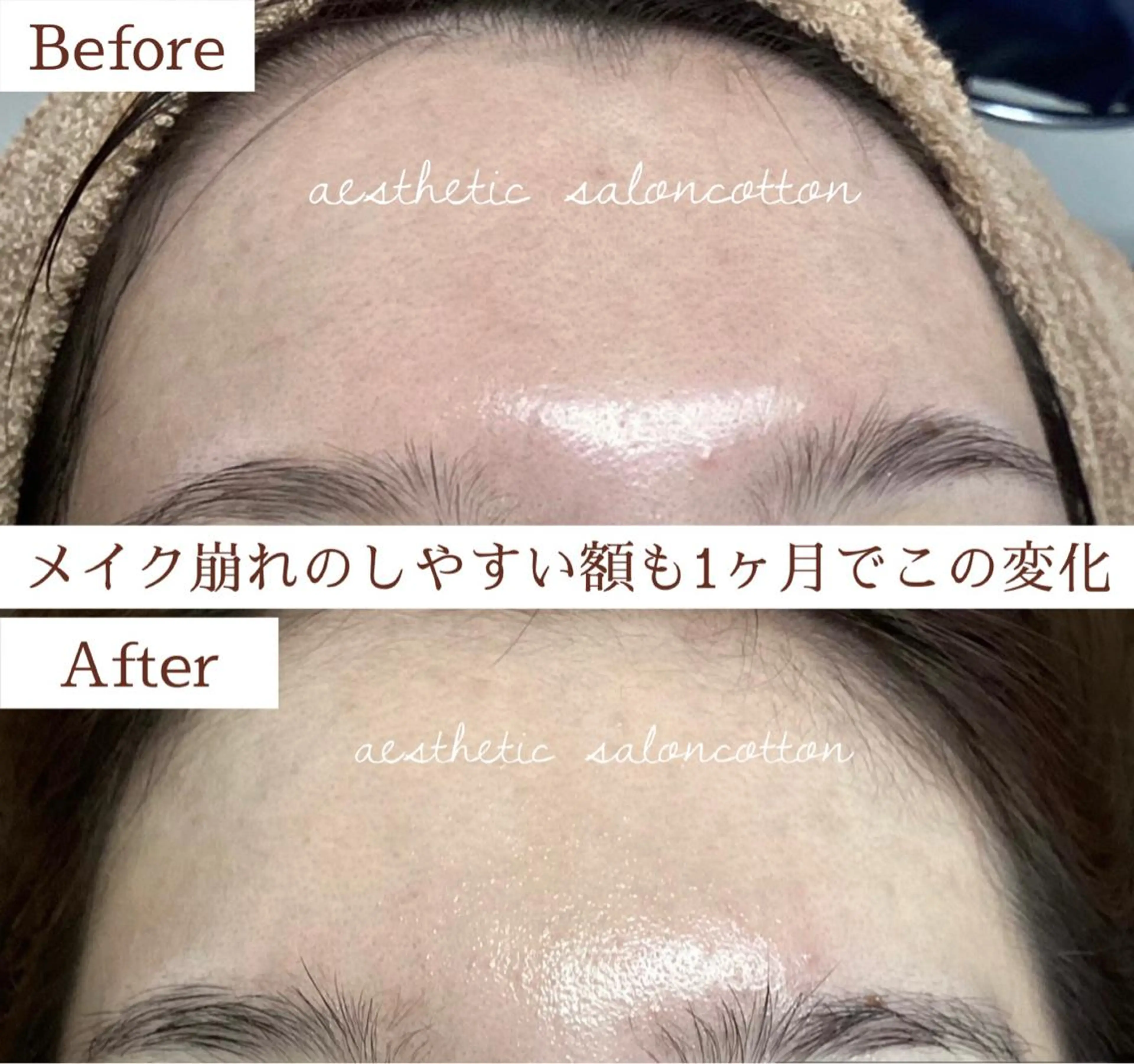 都度払い 肌質改善専門サロンのエステ・リラクイメージ