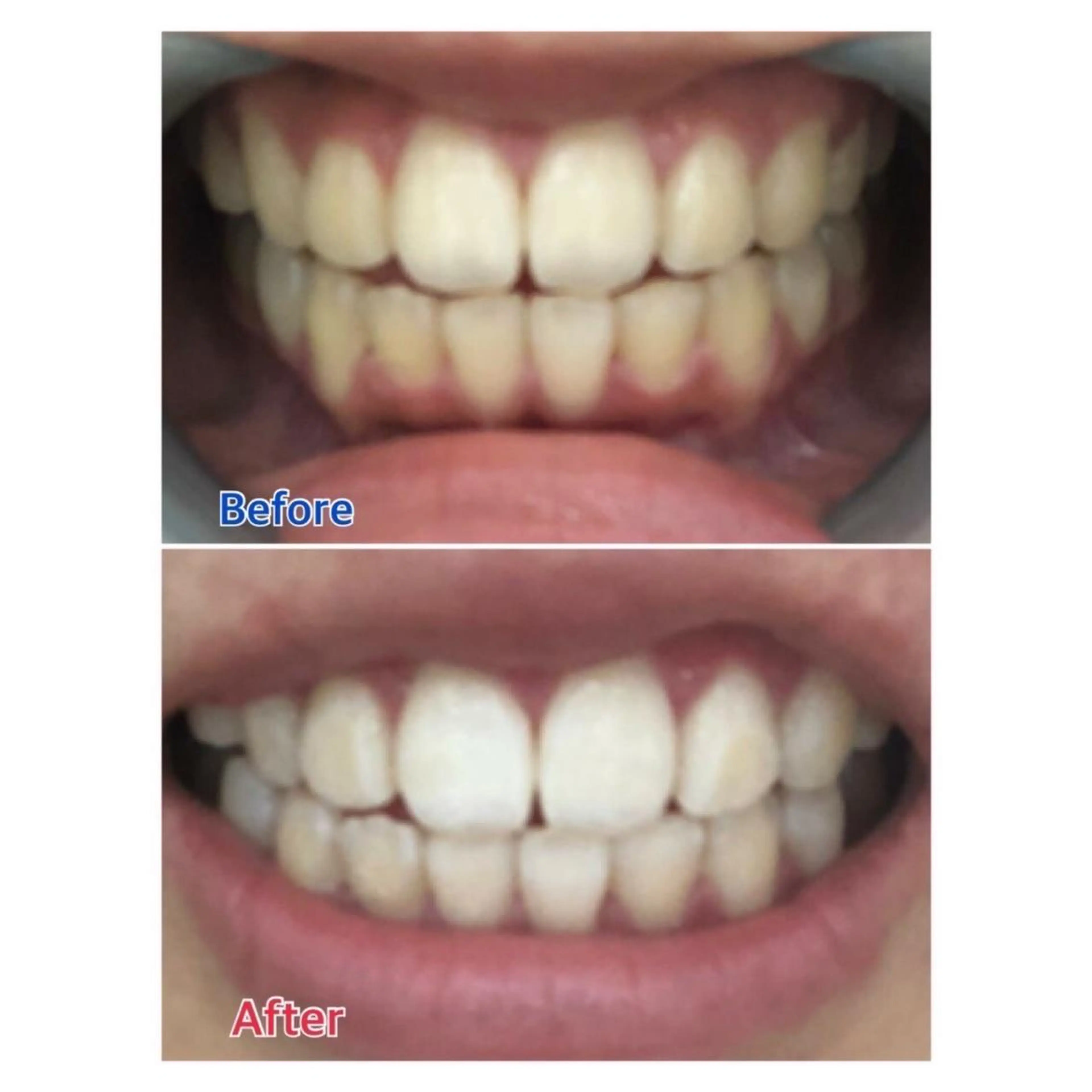 M渋谷店所属・M渋谷 ホワイトニングのエステ・リラクイメージ