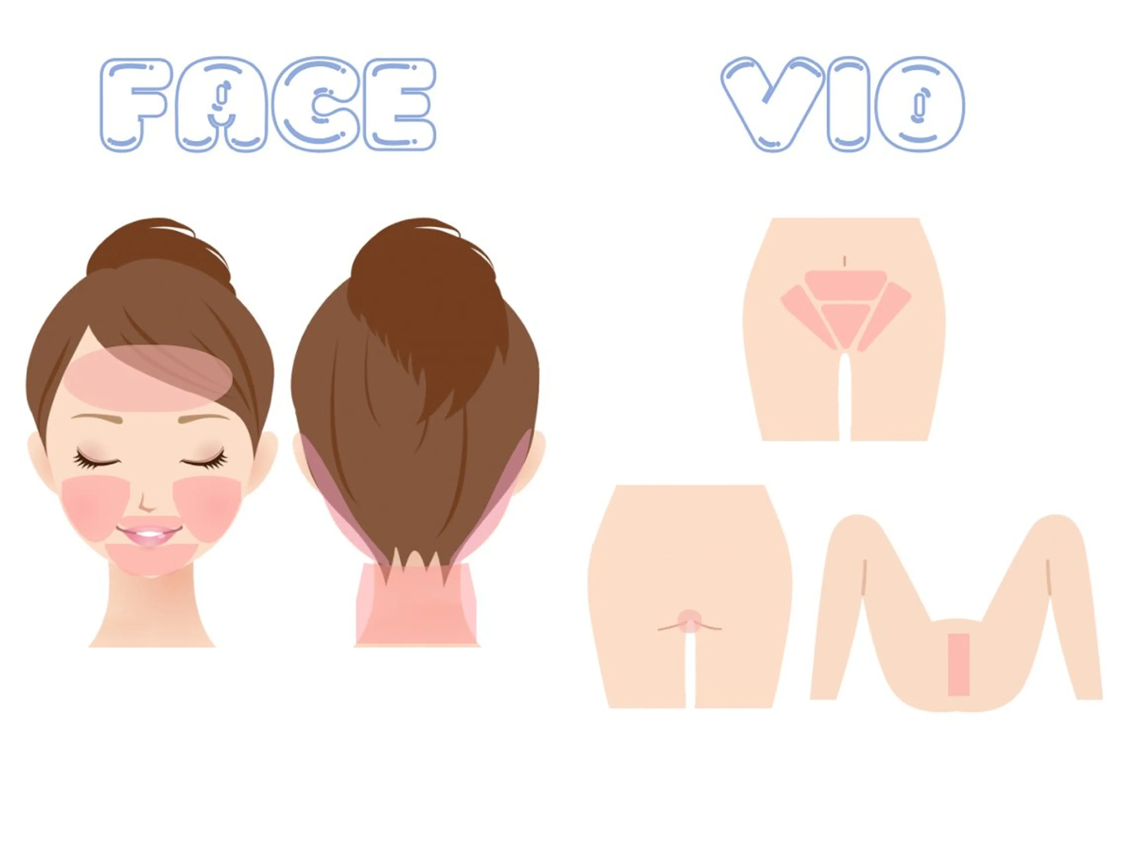 【女性専用】VIOデリケートゾーン脱毛3回Setの写真