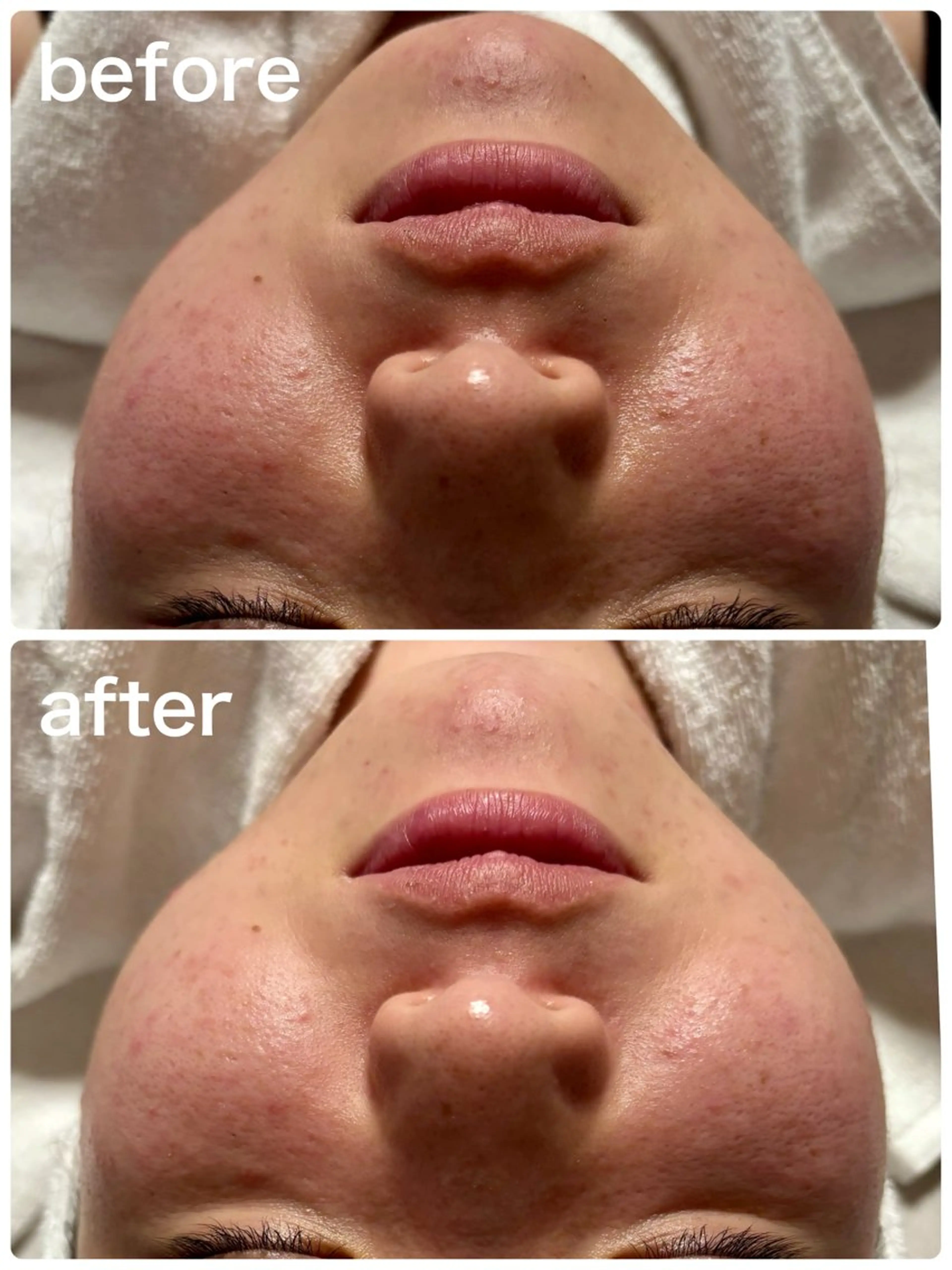 NONOKEKE ノノケケのエステ・リラクイメージ