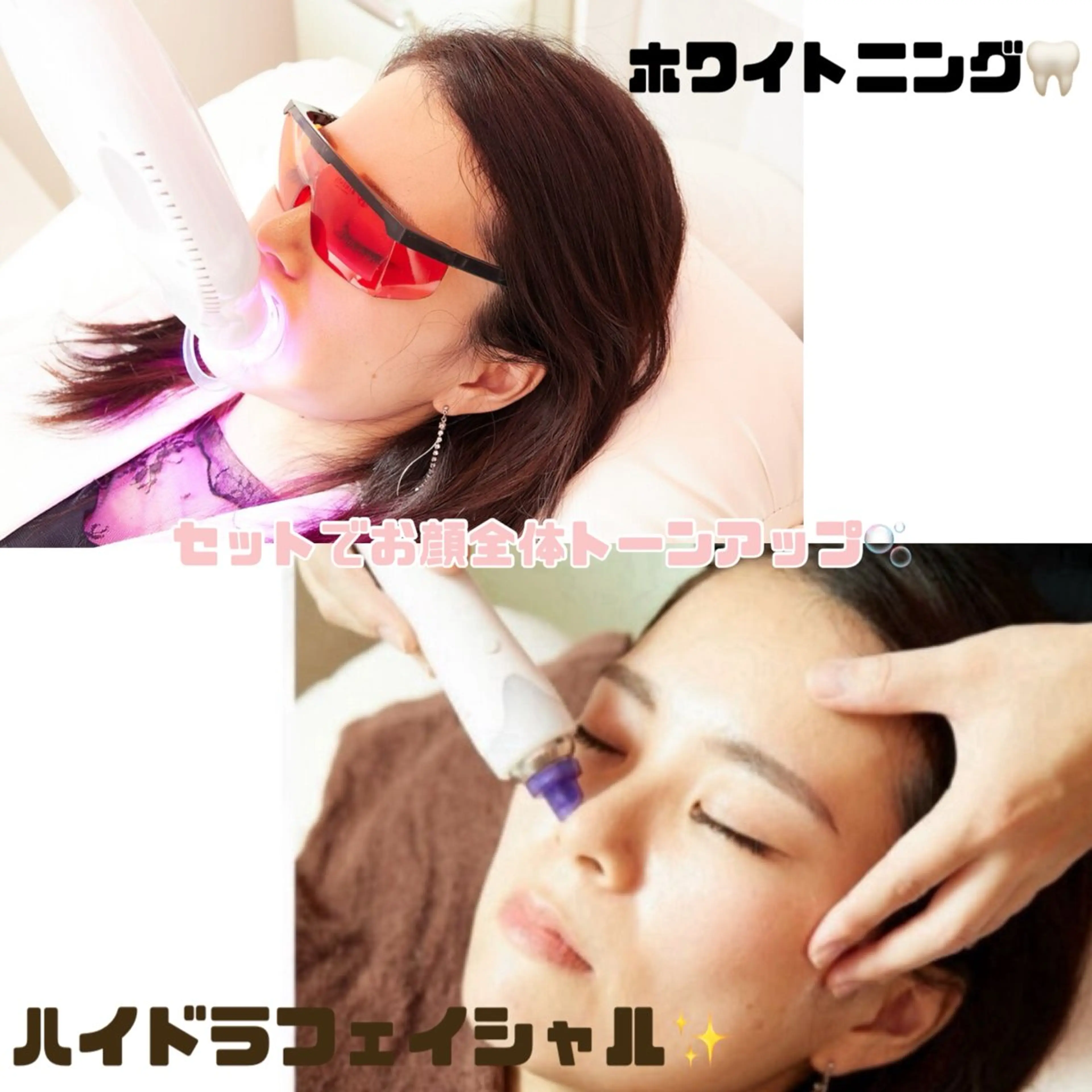 大人気ハイドラフェイシャルで毛穴洗浄と、歯のホワイトニングのお得なセット🦷✨ （モニター価格）の写真