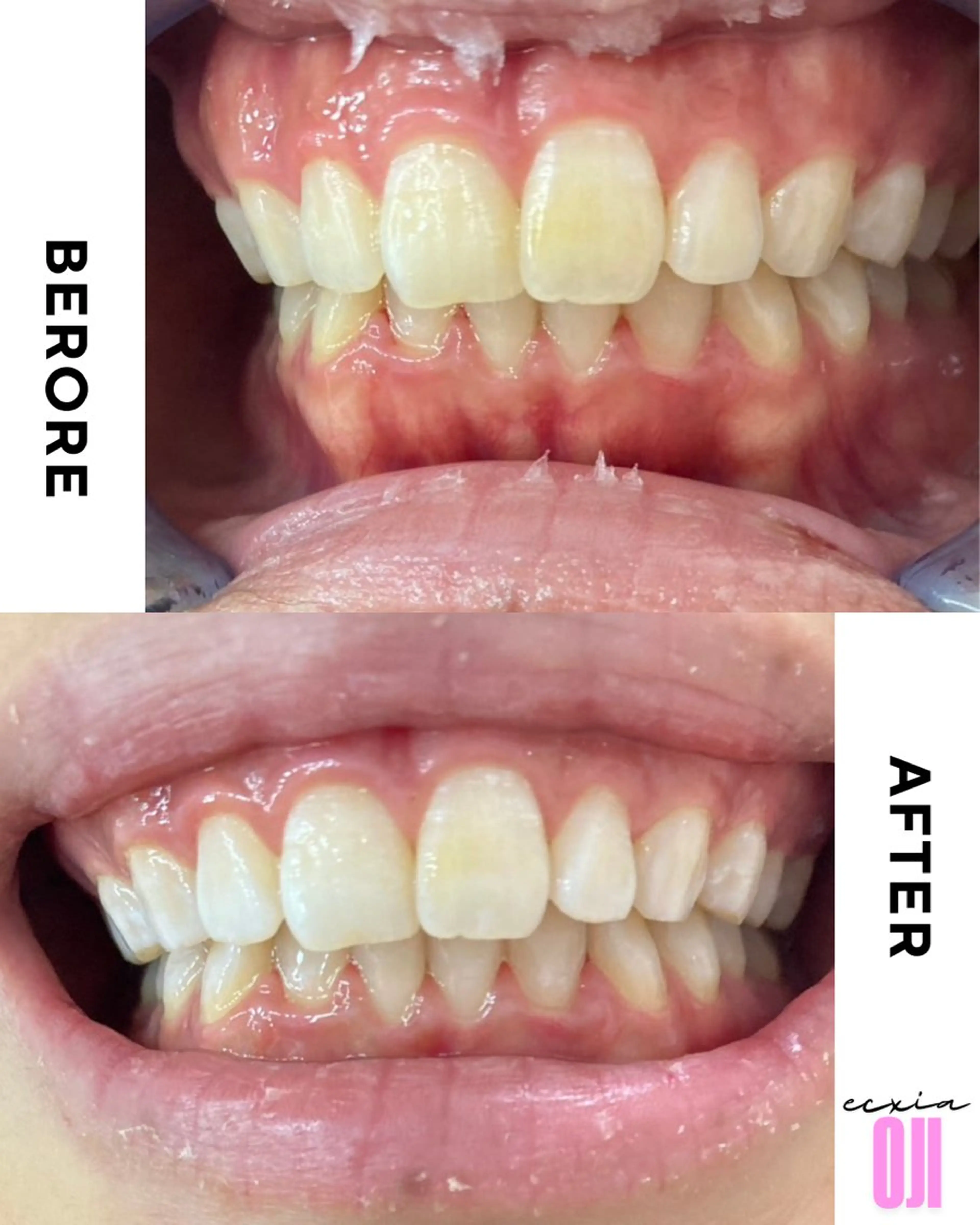 その他 セルフホワイトニングサロン  エクシアホワイト 王寺店所属・エクシア王寺 NISHIKAWAのその他イメージ