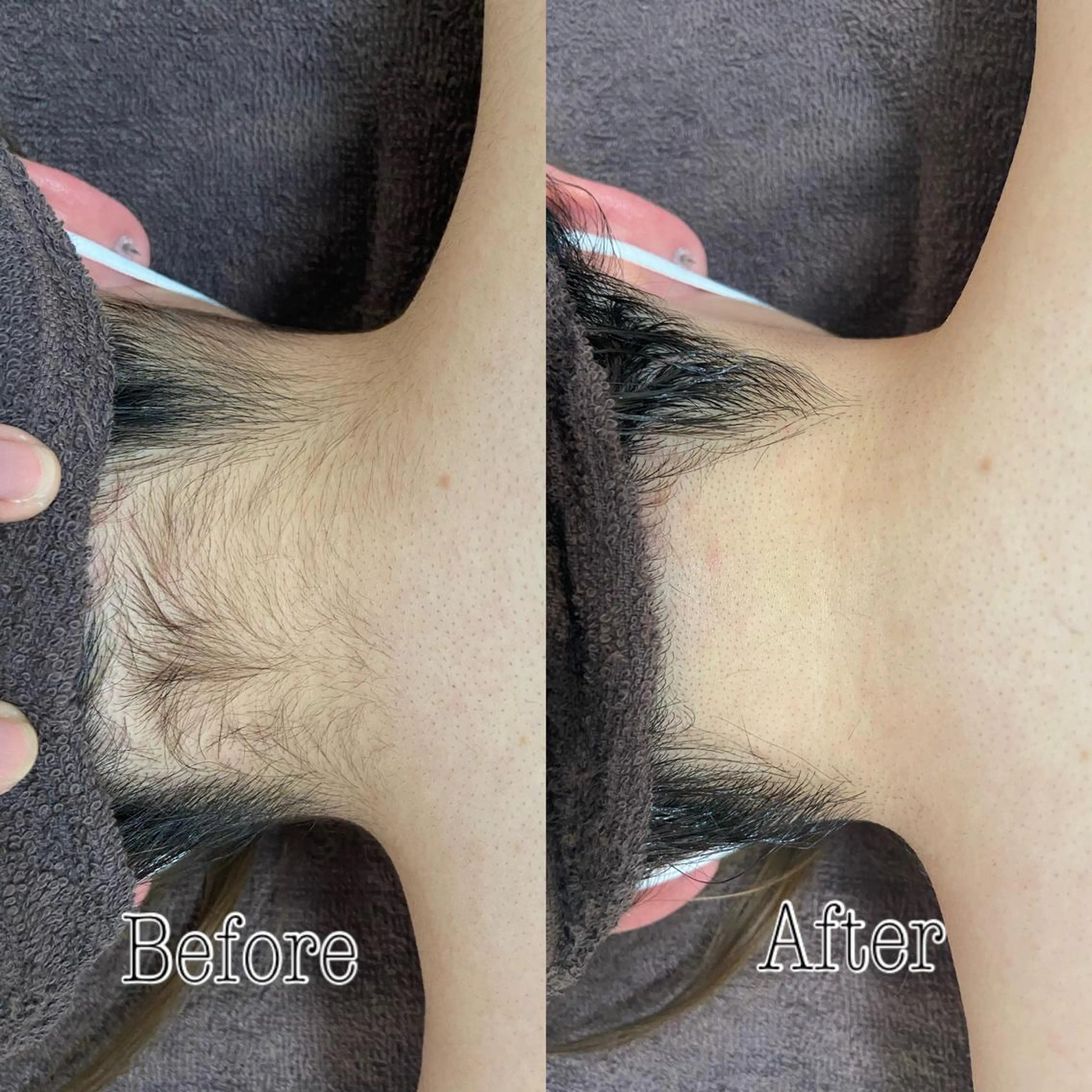 都度払い制脱毛サロンBe Charm所属・Be Charm 山﨑のエステ・リラクイメージ