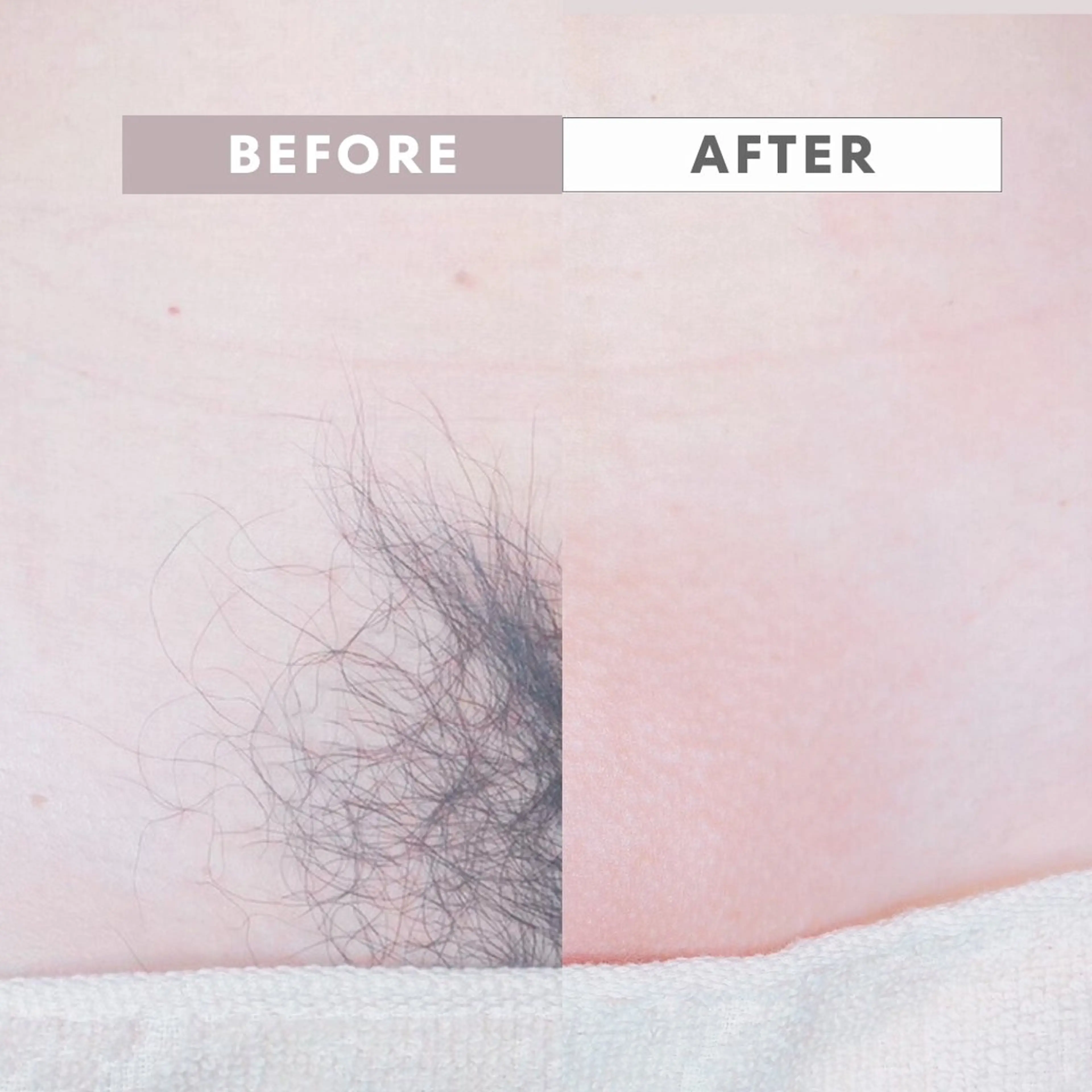 脱毛 sugaring salon Malo所属・シュガーリングサロン Maloのエステ・リラクイメージ