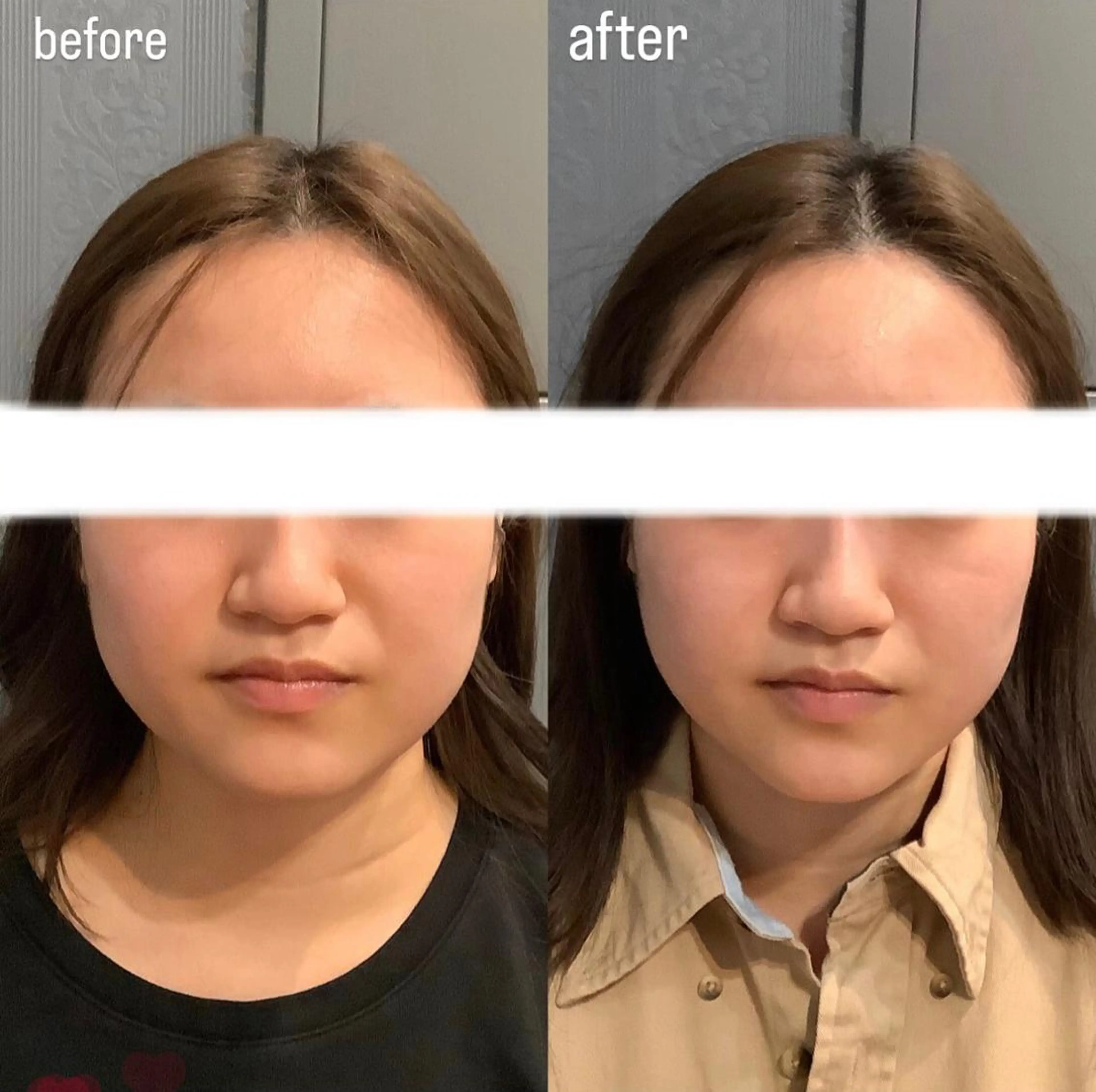 エステ リラク エステサロンino.colore'所属・小顔サロン ino.coloreのエステ・リラクイメージ