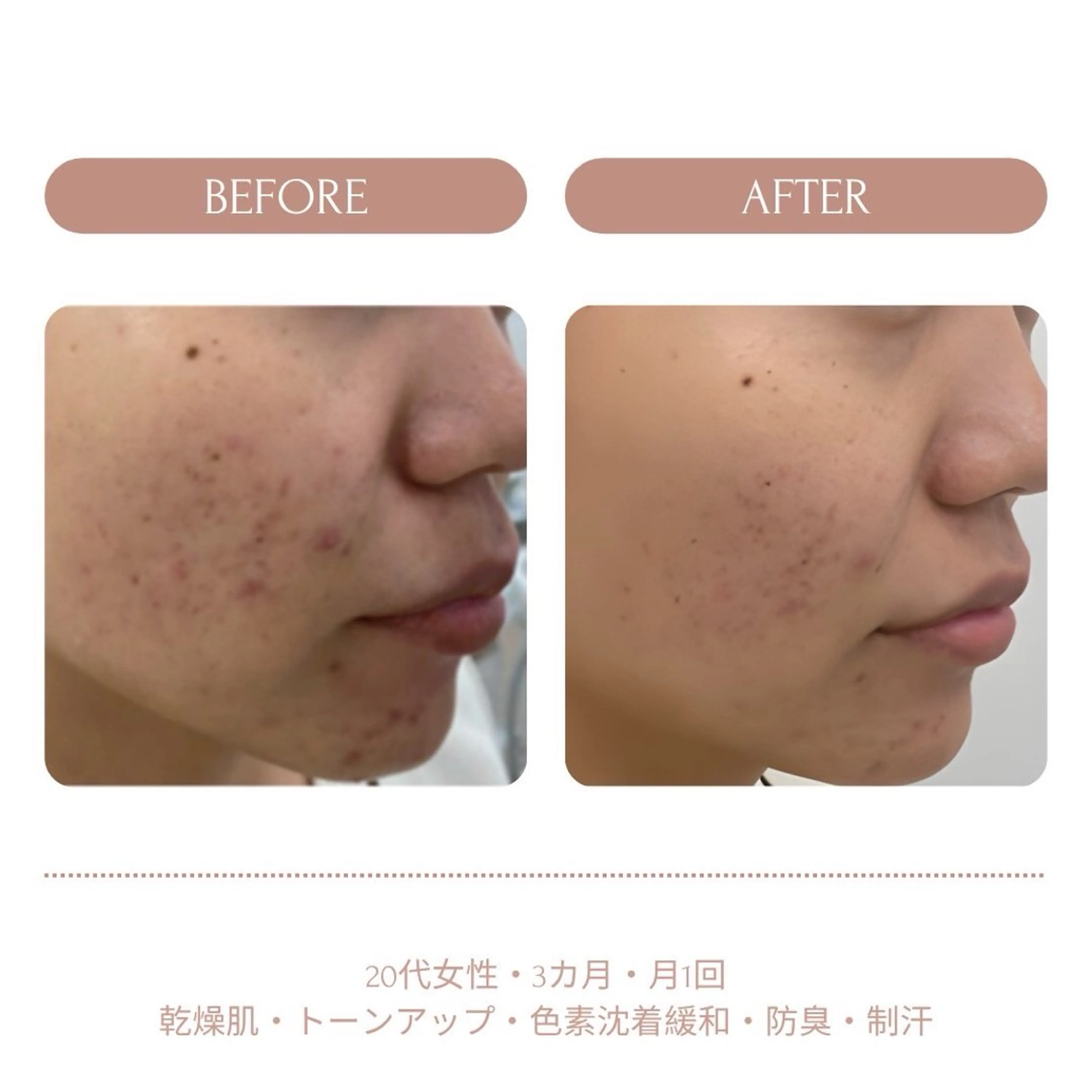 脱毛　Beauty salon Lumiere（ルミエール）所属・完全都度払い脱毛⭐︎ Lumiereのエステ・リラクイメージ