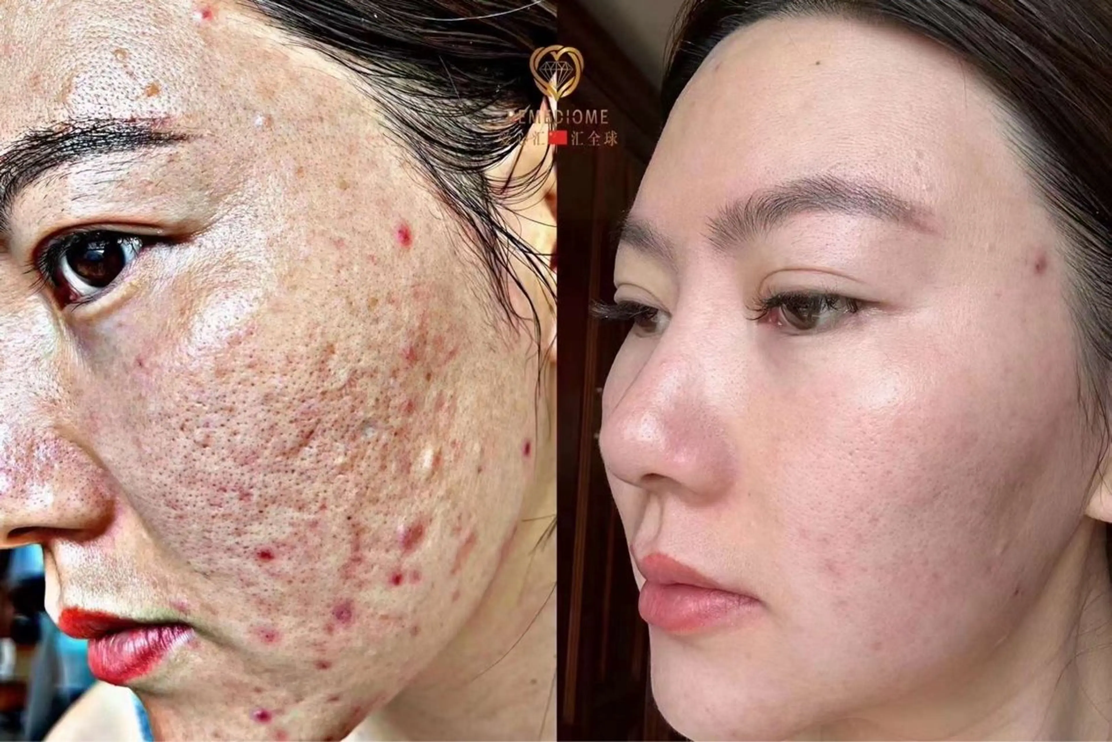 エステ 上福岡 らんらんのネイルデザイン