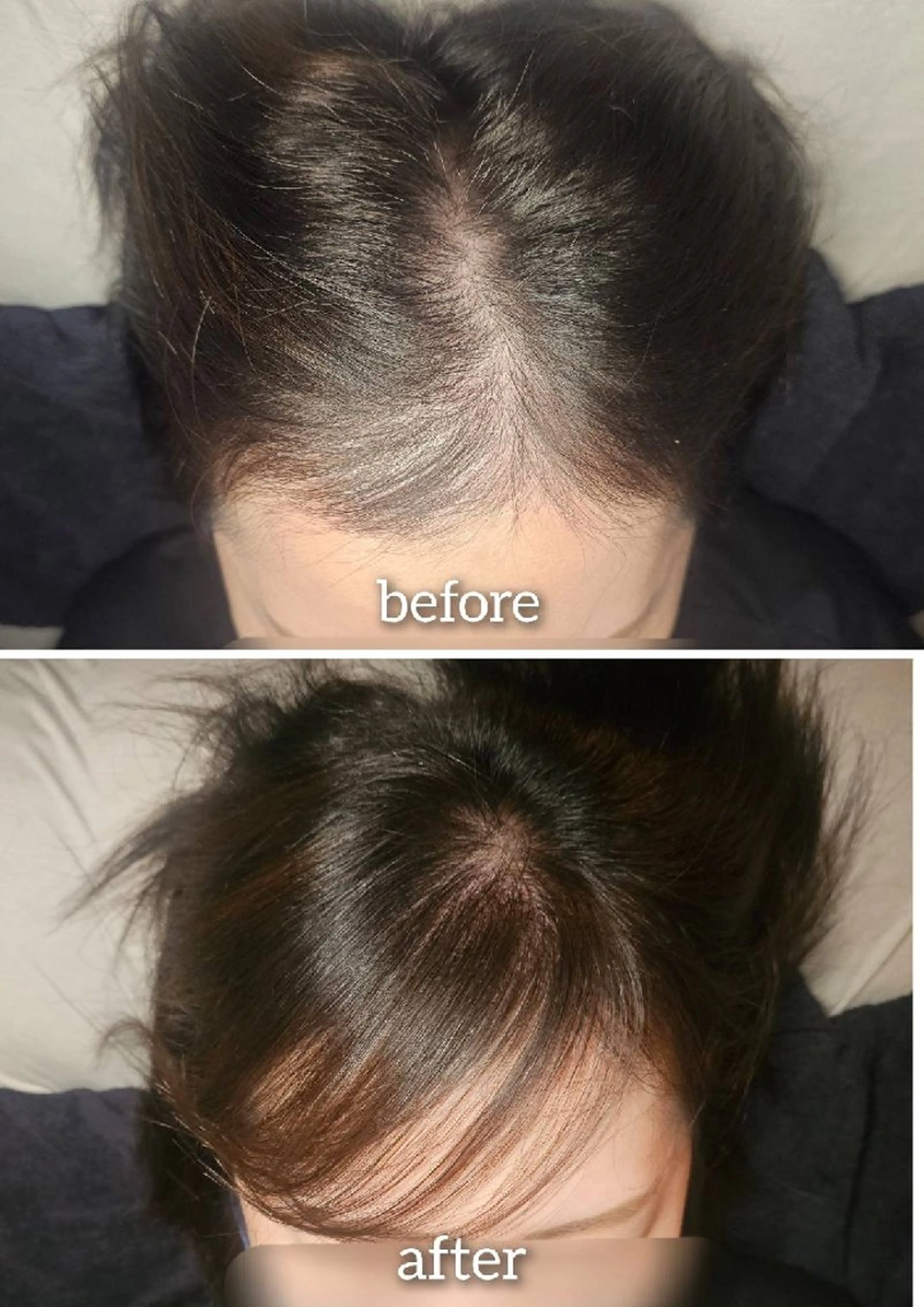 歯科提携セルフダック 宇都宮駒生店のエステ・リラクイメージ