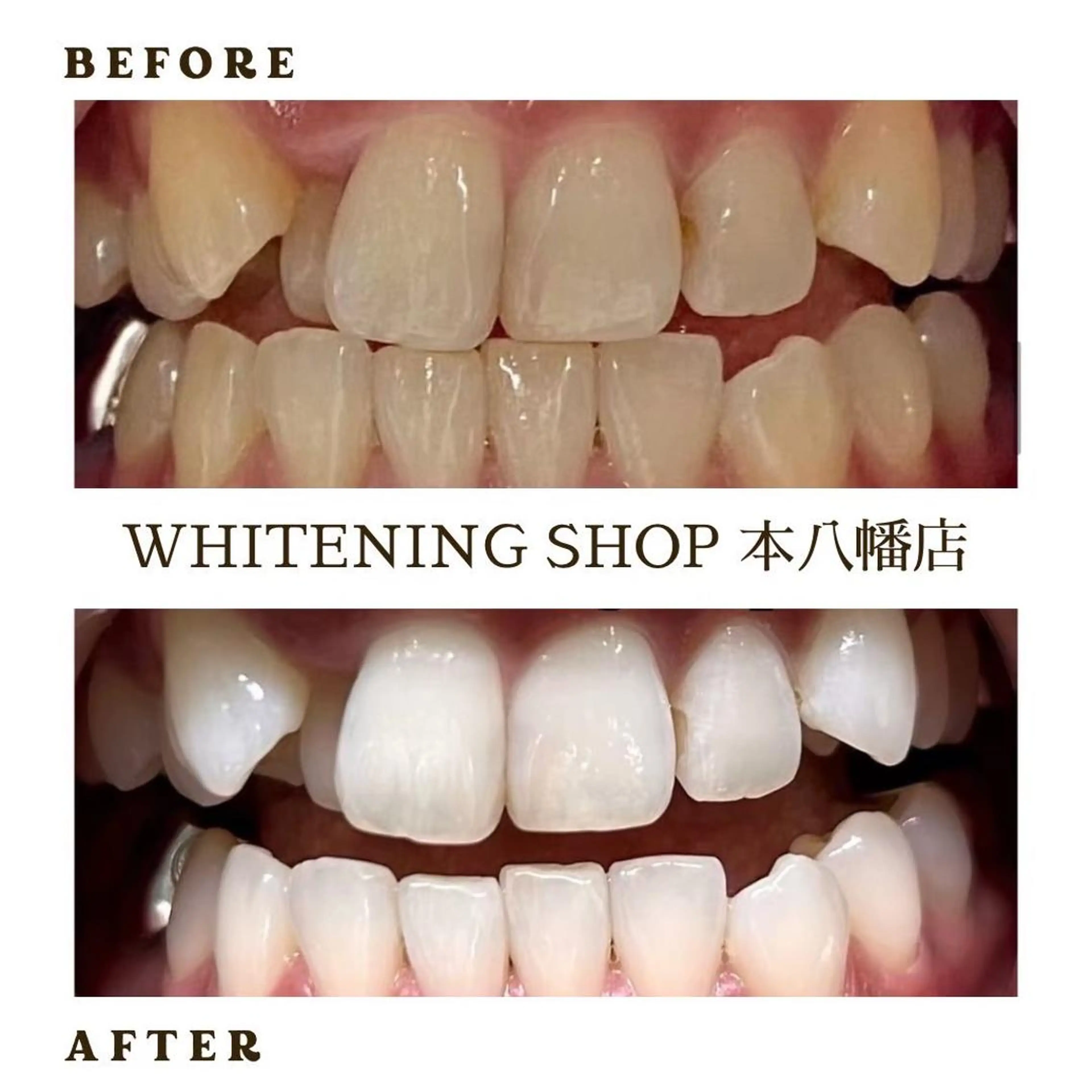 メンズ エステ リラク ホワイトニング ショップ本八幡店のエステ・リラクイメージ