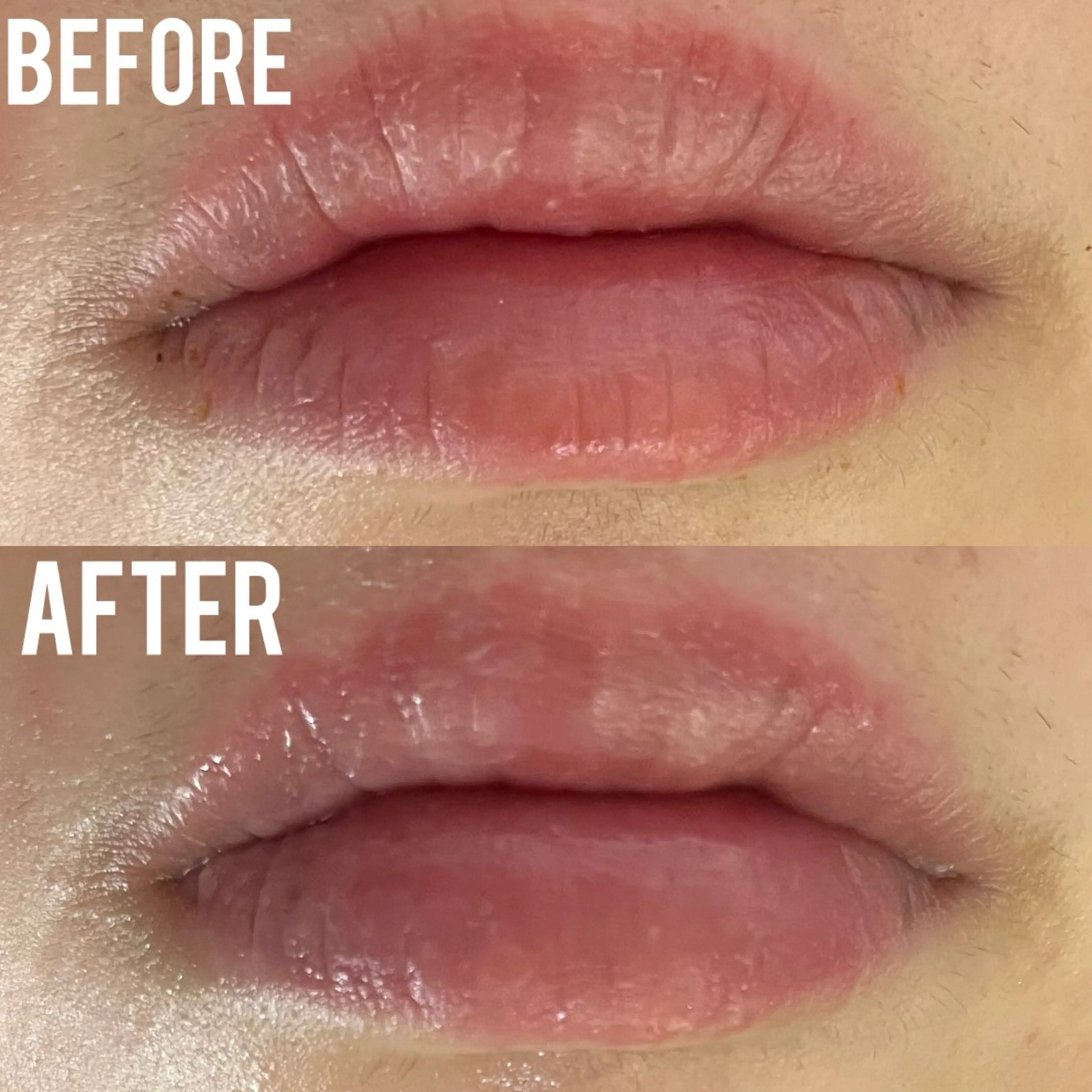 エステ MEITY新宿所属・小顔、毛穴ケア 通い放題エステのエステ・リラクイメージ