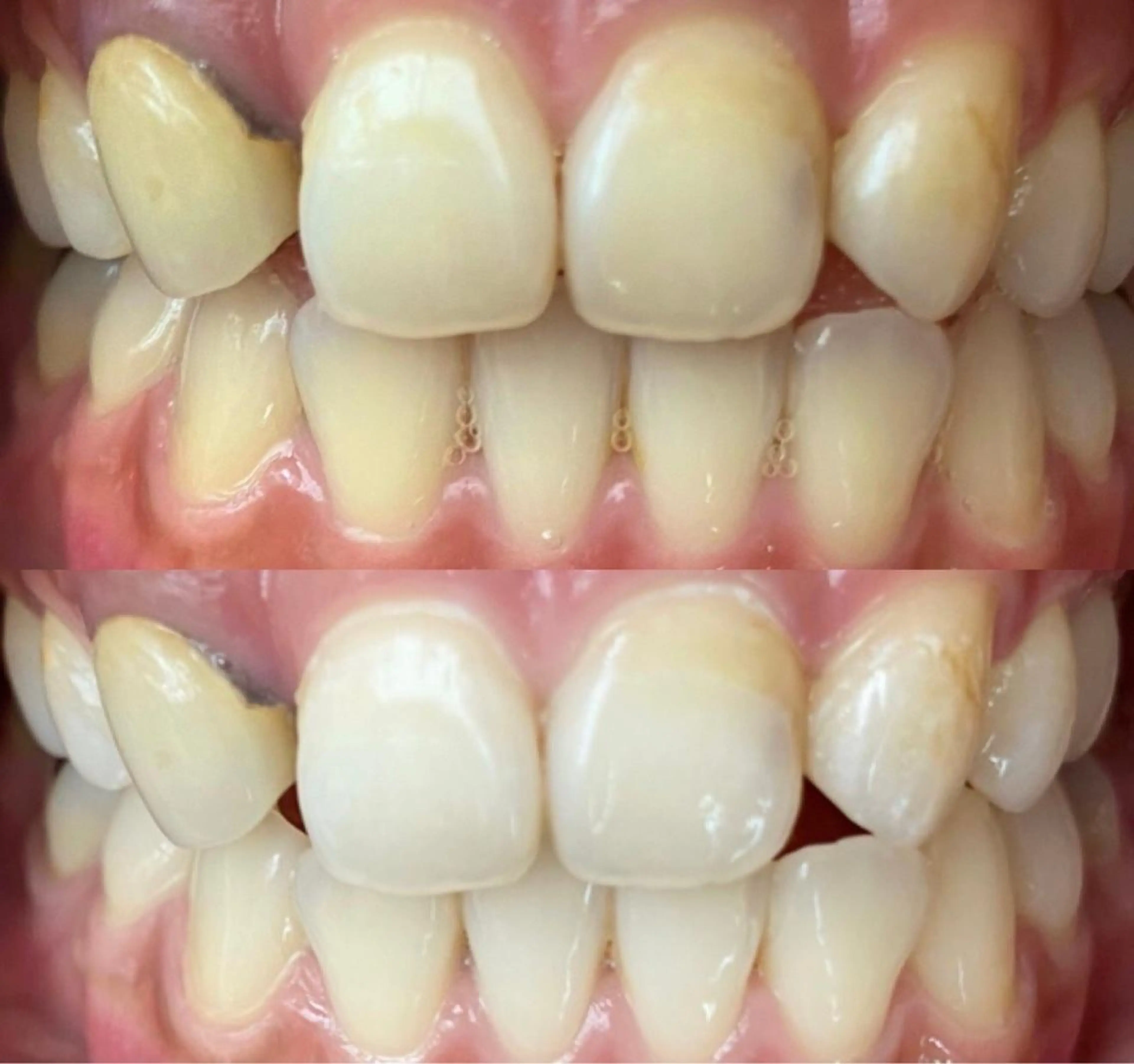 ロング カラー パーマ ヘアアレンジ ネイル マツエク・マツパ アイブロウ ホワイト LBSホワイトニング 🌐梅田店公式のエステ・リラクイメージ