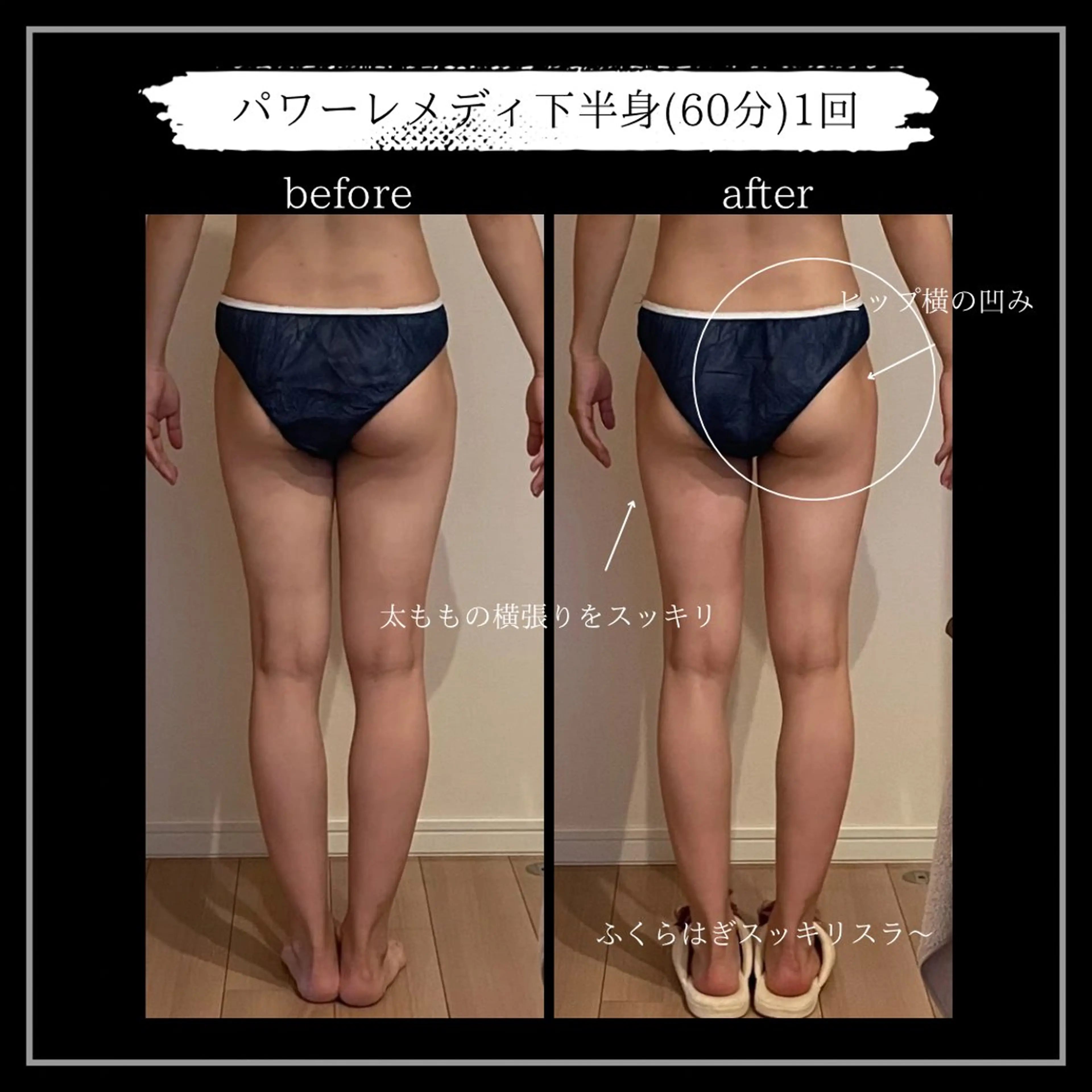 オフ:オン所属・オフ:オン 全身筋膜マッサージのエステ・リラクイメージ