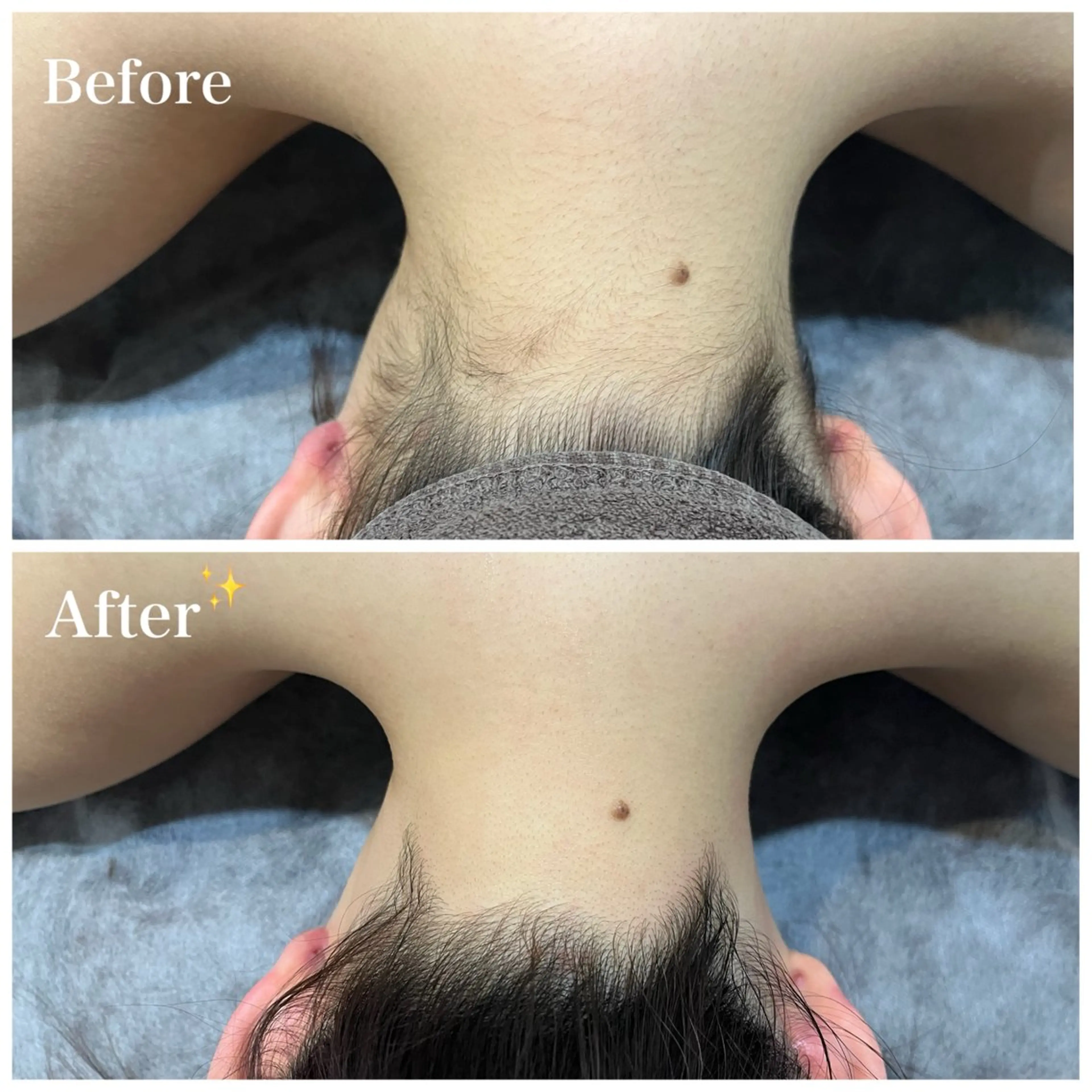 脱毛 脱毛サロン fam.豊澤柚良のエステ・リラクイメージ