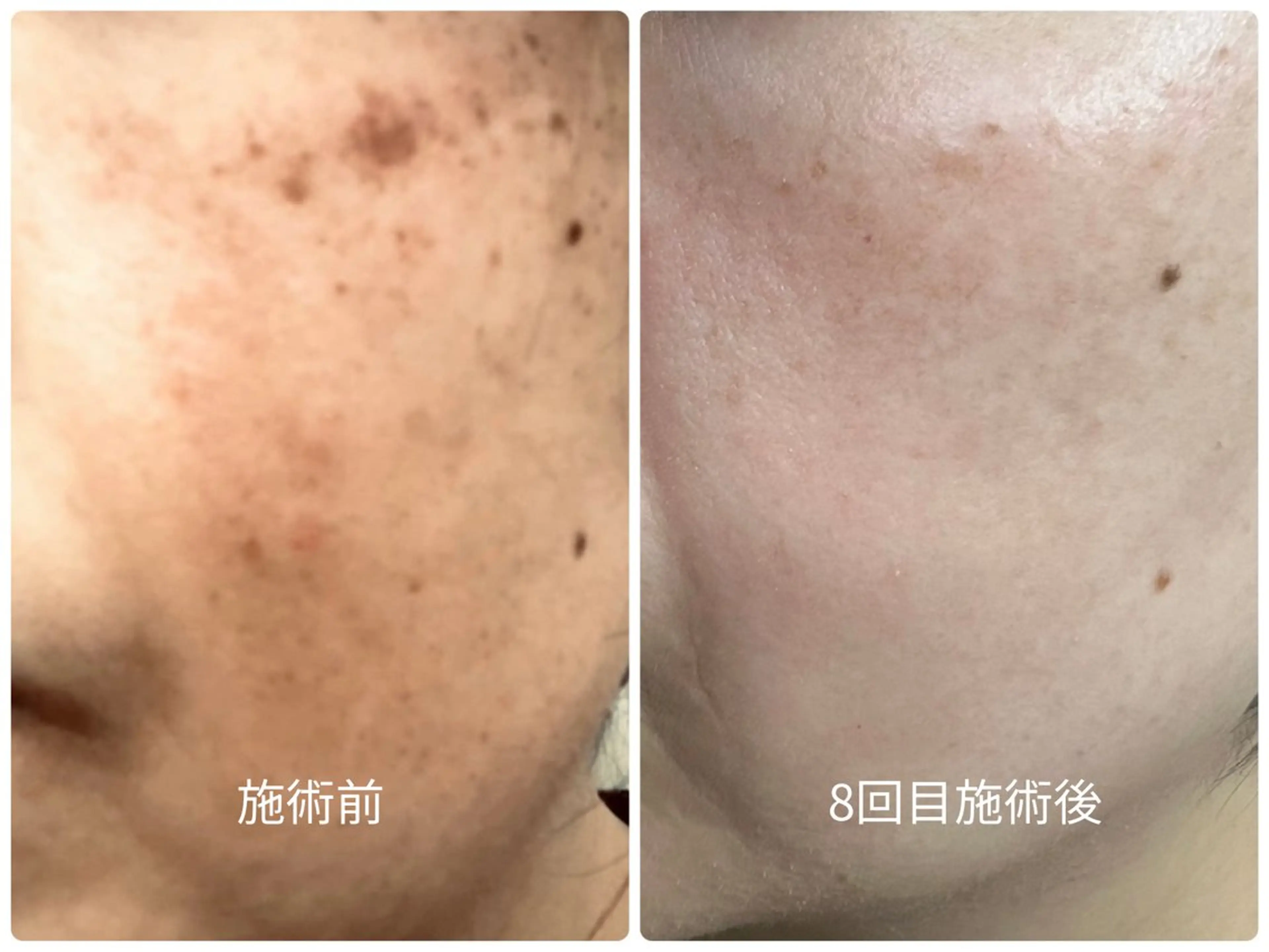 エステ スリーエスプラス内　美肌サロンEme所属・希映 -kieのエステ・リラクイメージ